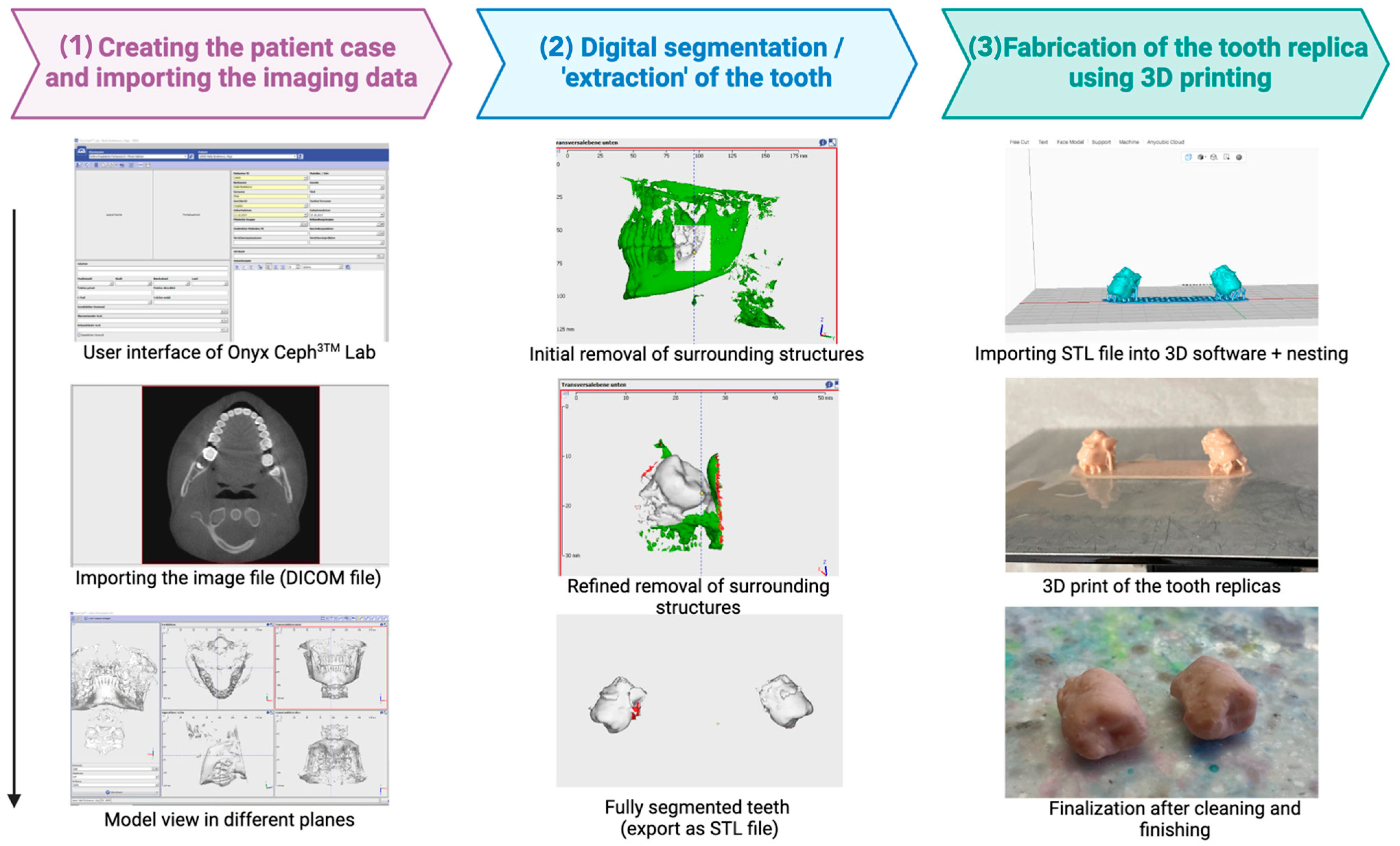 Dentistry 13 00281 g001