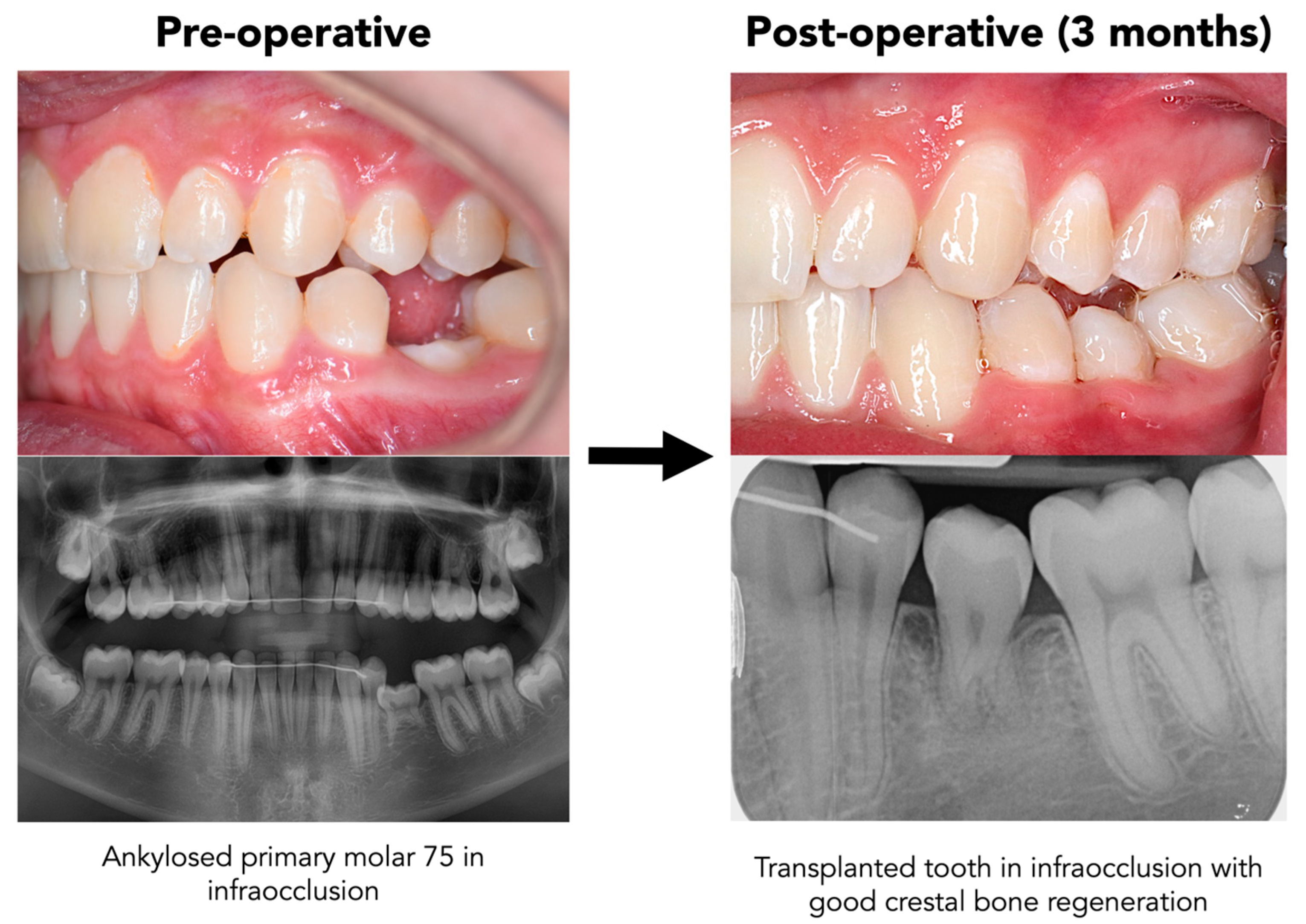Dentistry 13 00281 g003