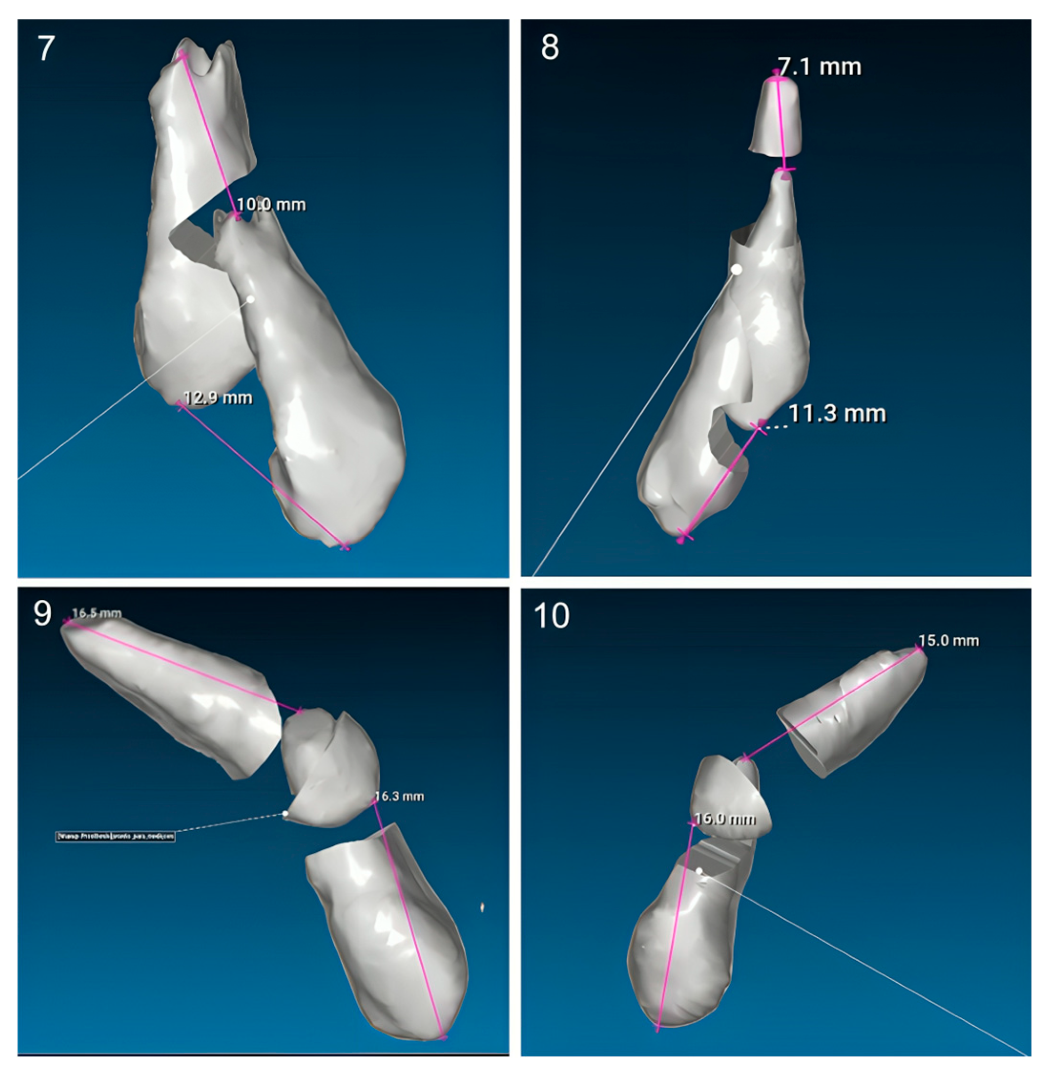 Dentistry 13 00286 g011