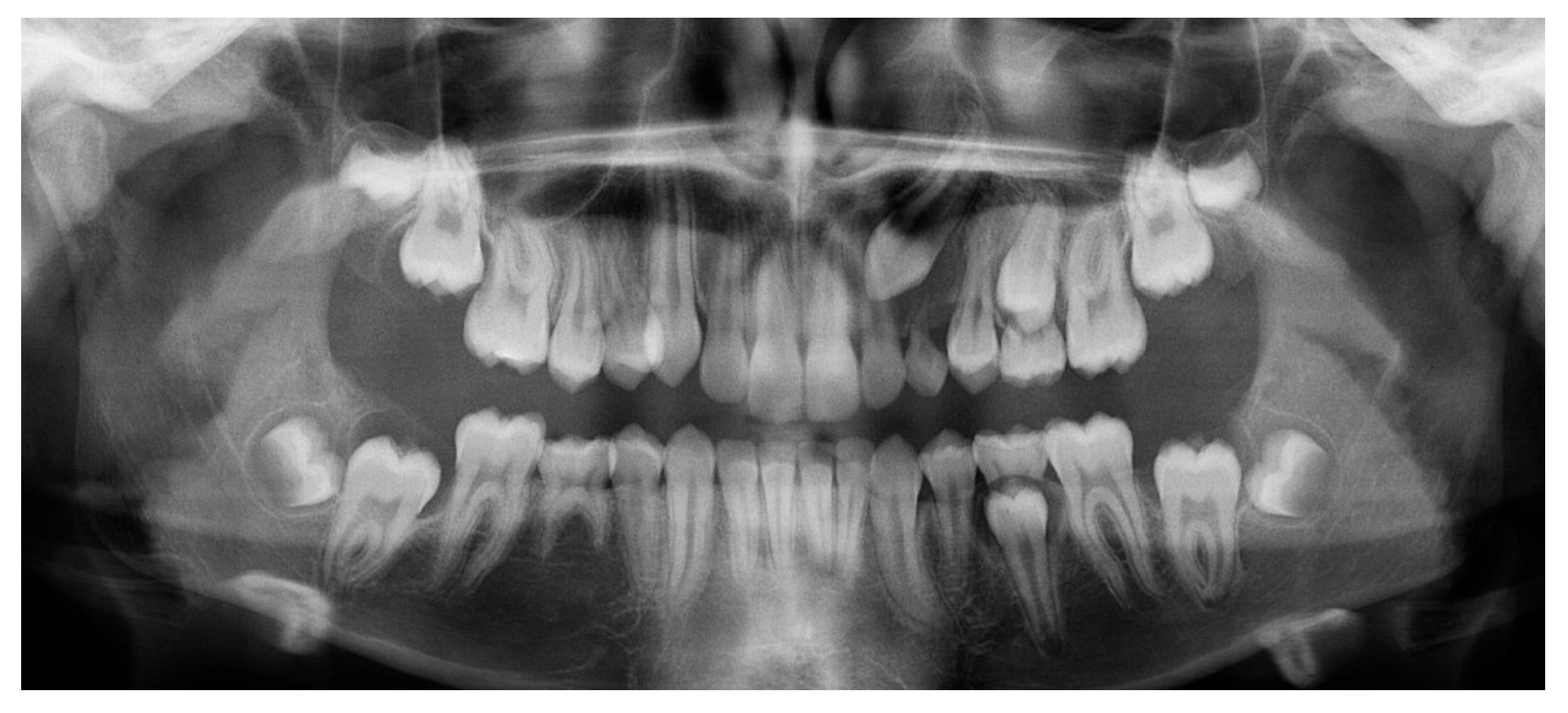 Dentistry 13 00286 g013