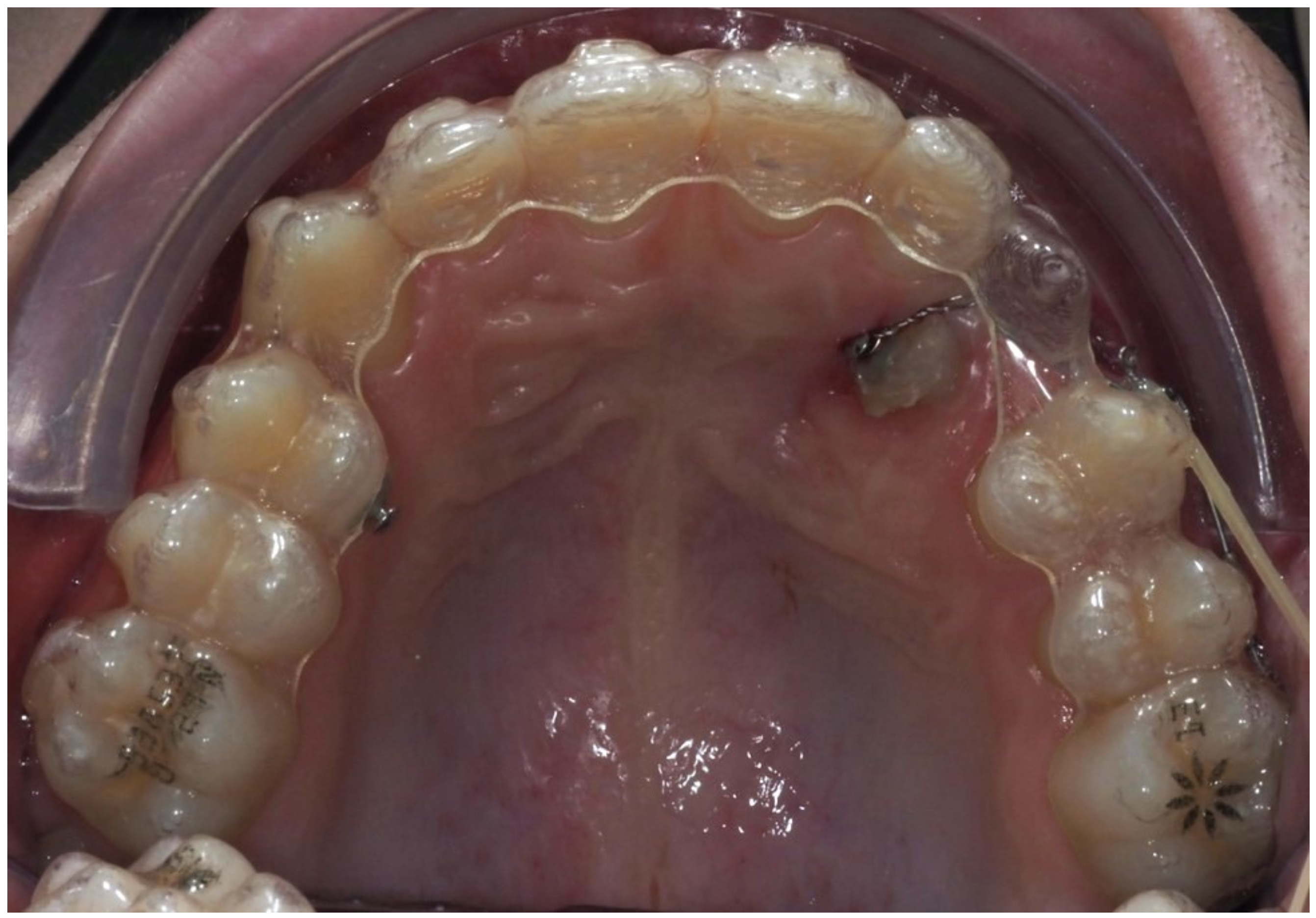 Dentistry 13 00286 g017