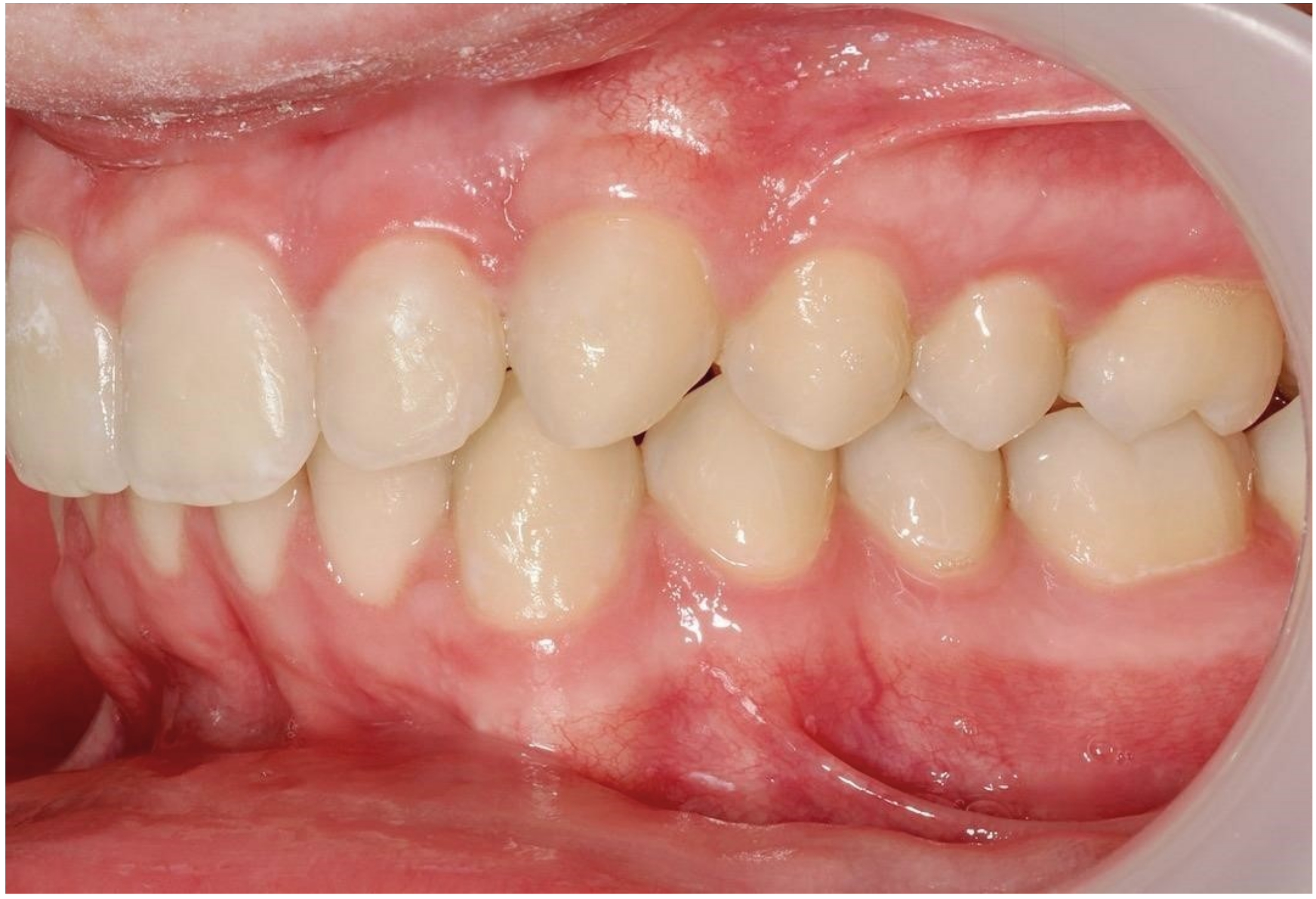 Dentistry 13 00286 g023