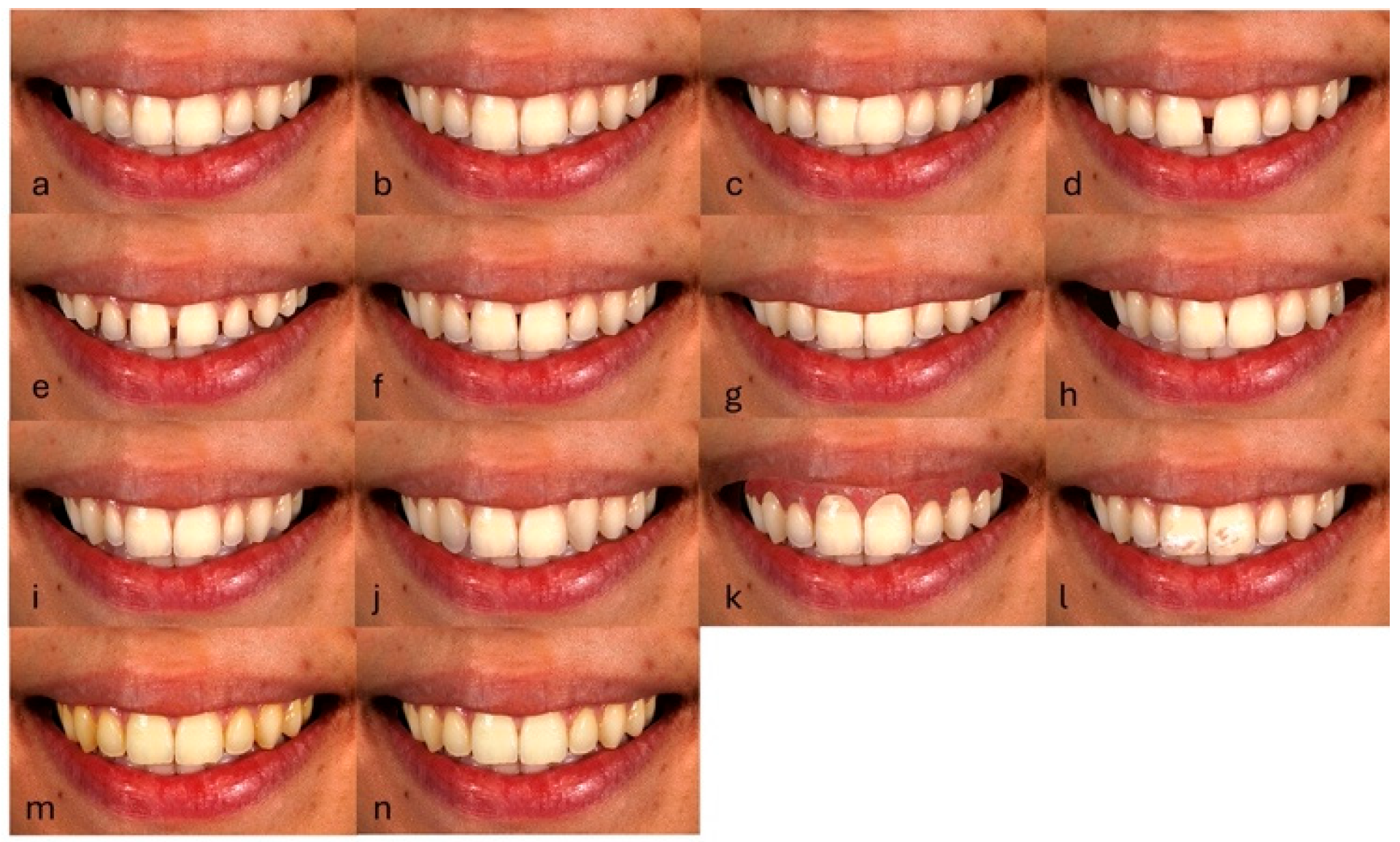 Dentistry 13 00287 g003