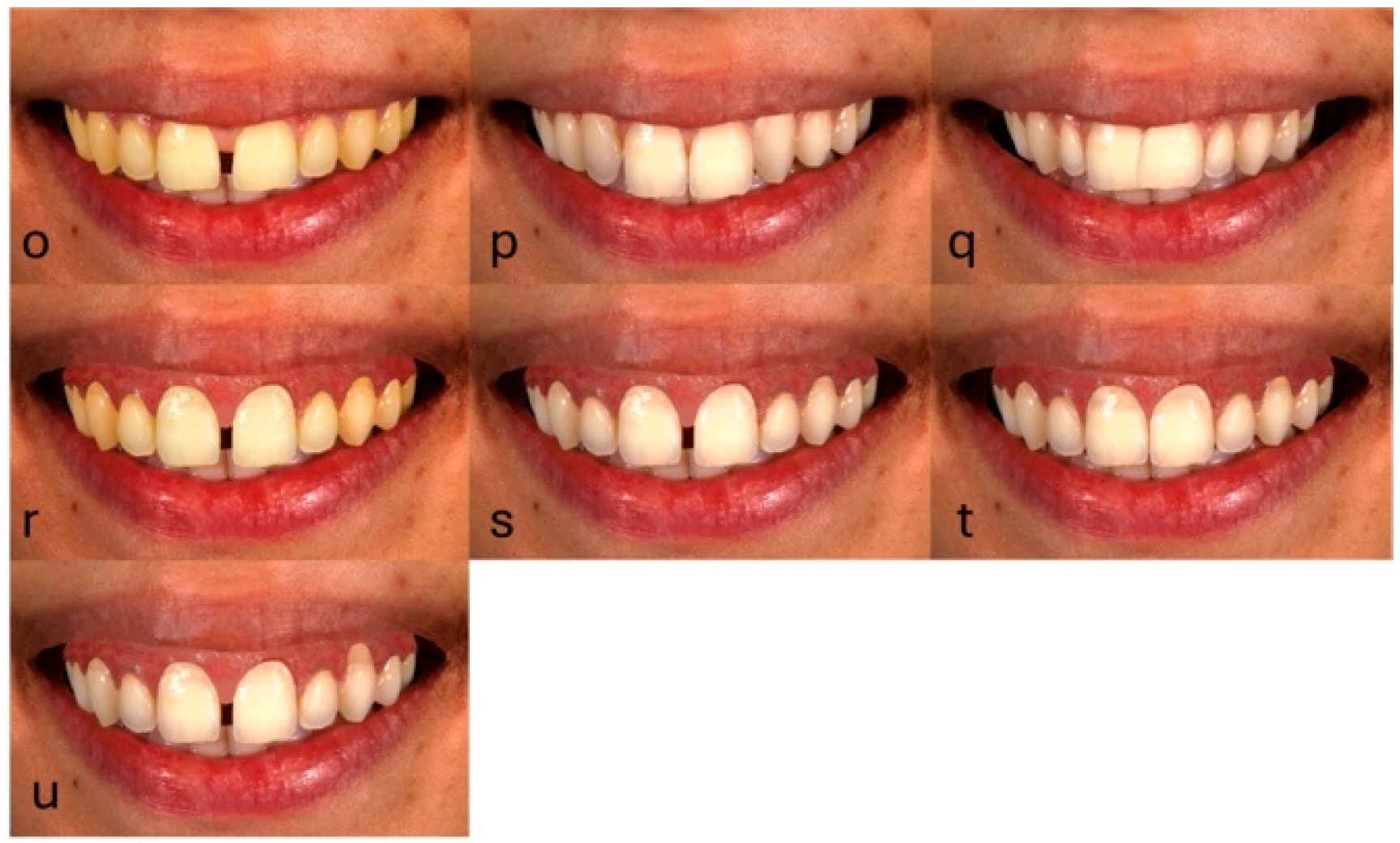 Dentistry 13 00287 g004