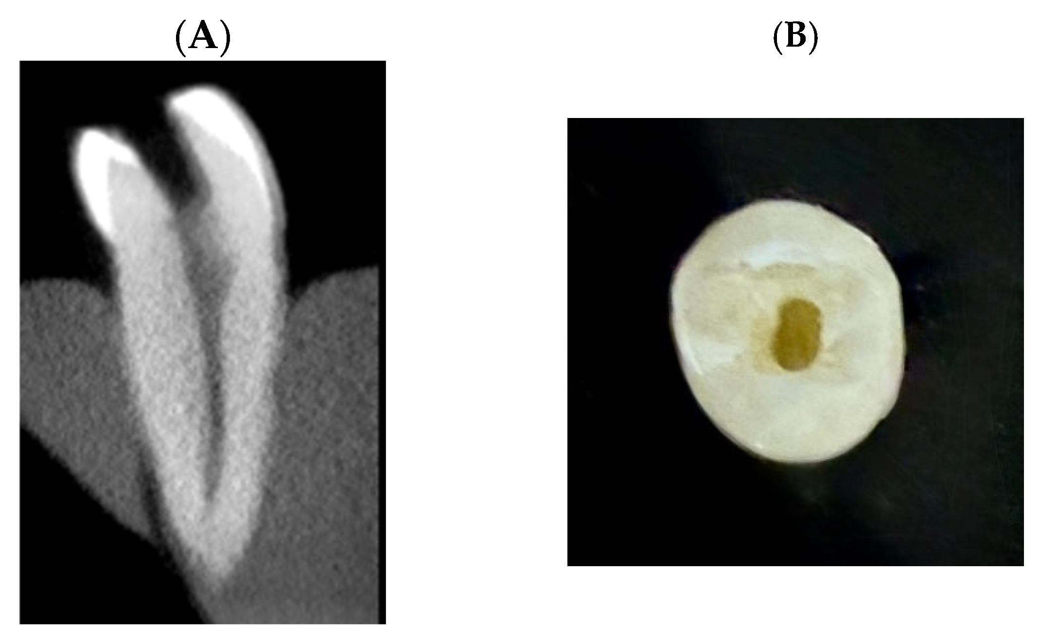 Dentistry 13 00295 g001
