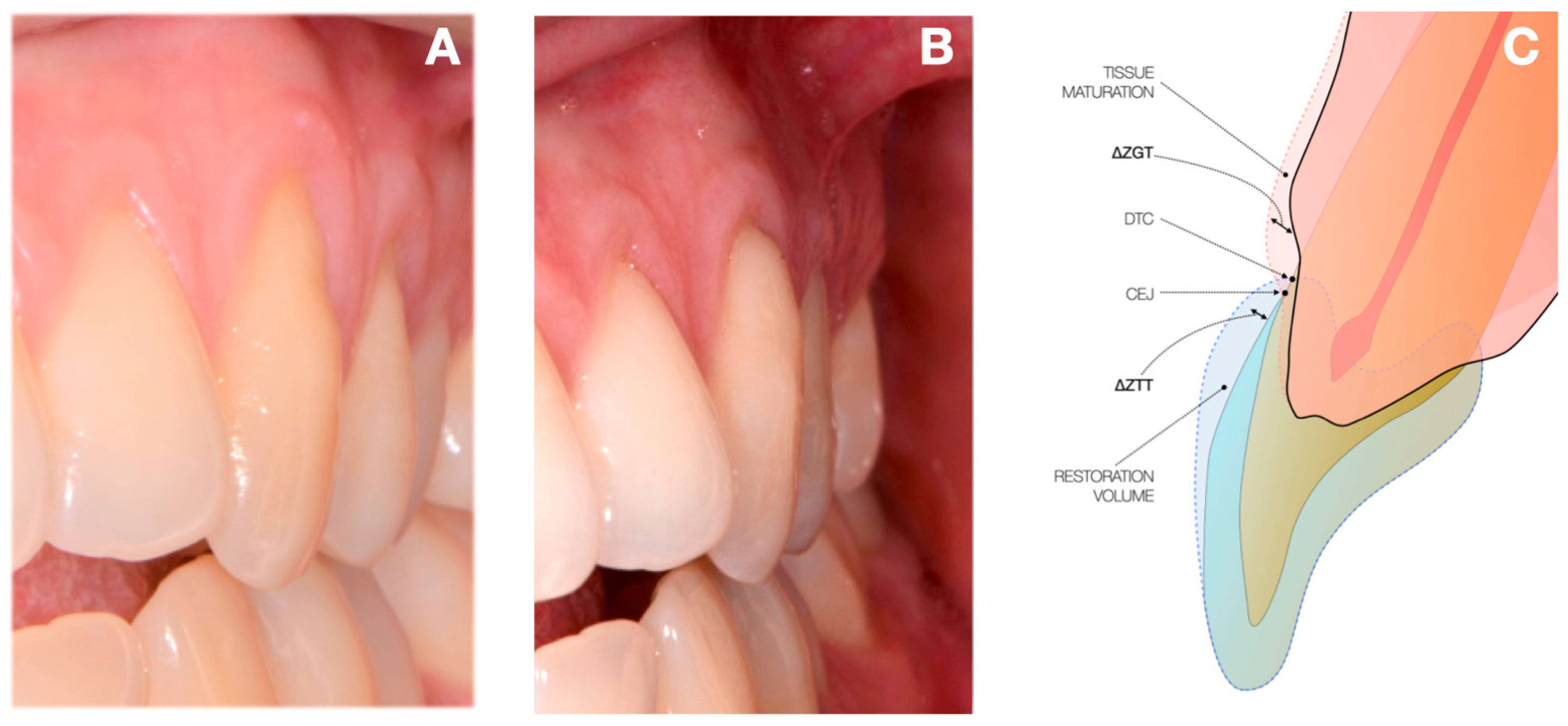 Dentistry 13 00296 g001