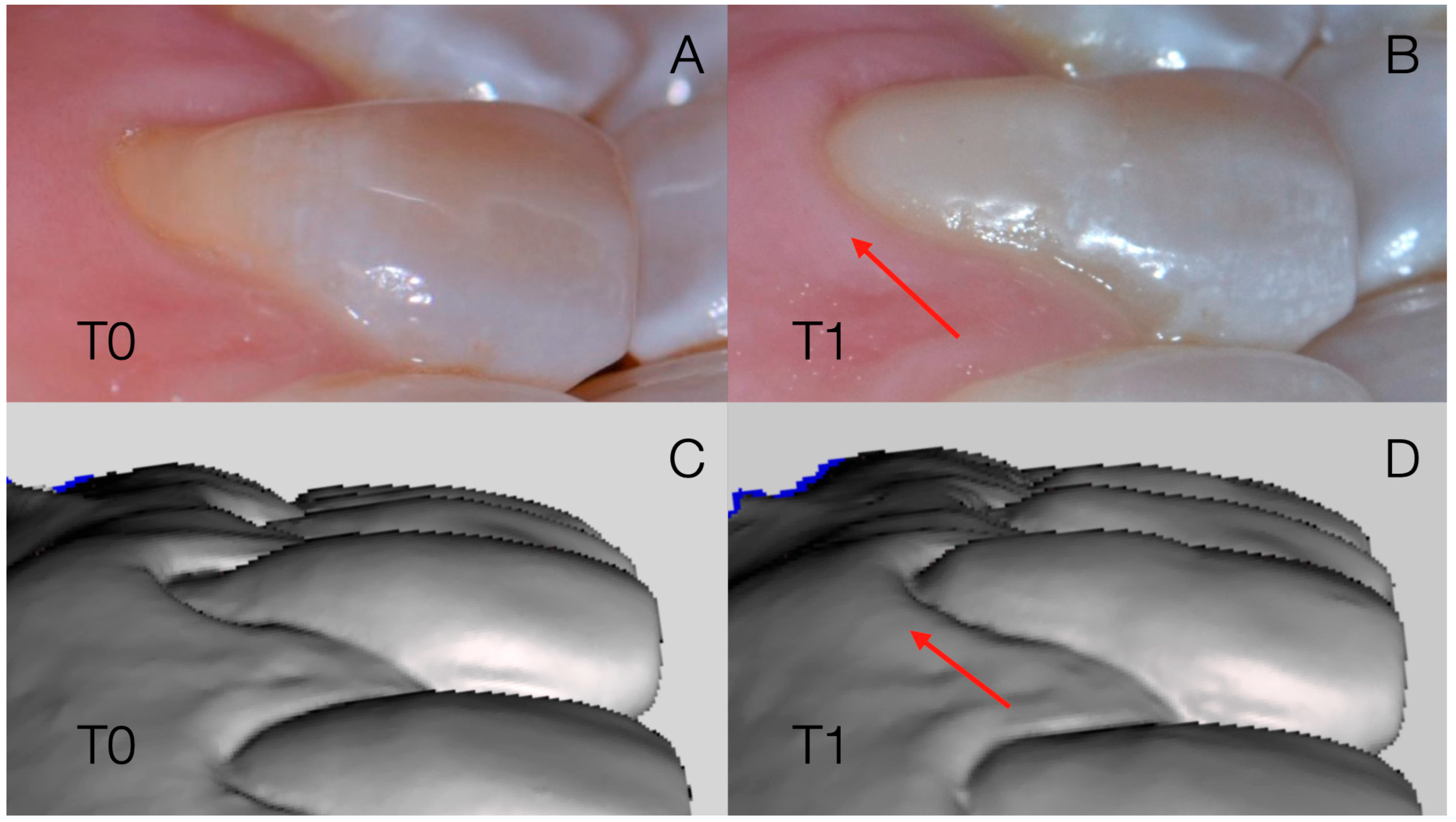 Dentistry 13 00296 g003