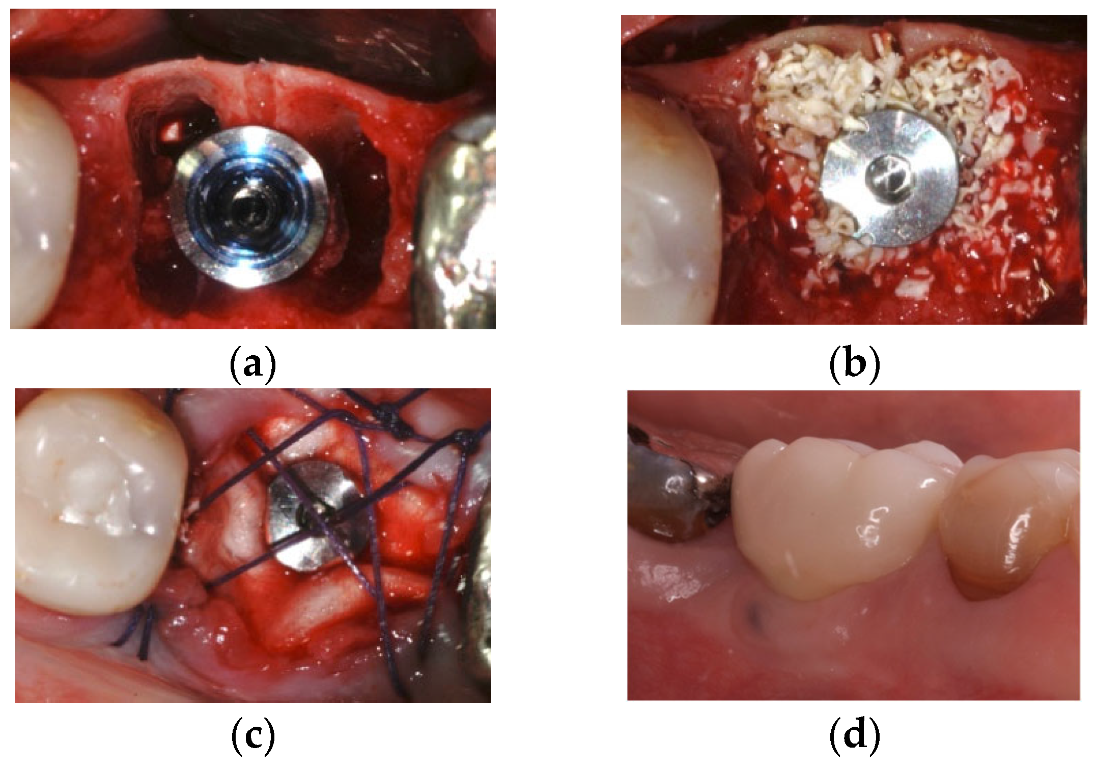 Dentistry 13 00299 g001 Dentistry 13 00299 g001