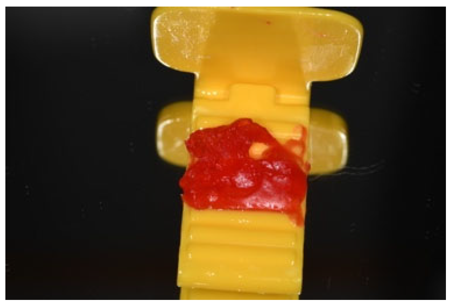 Dentistry 13 00299 g002 Dentistry 13 00299 g002