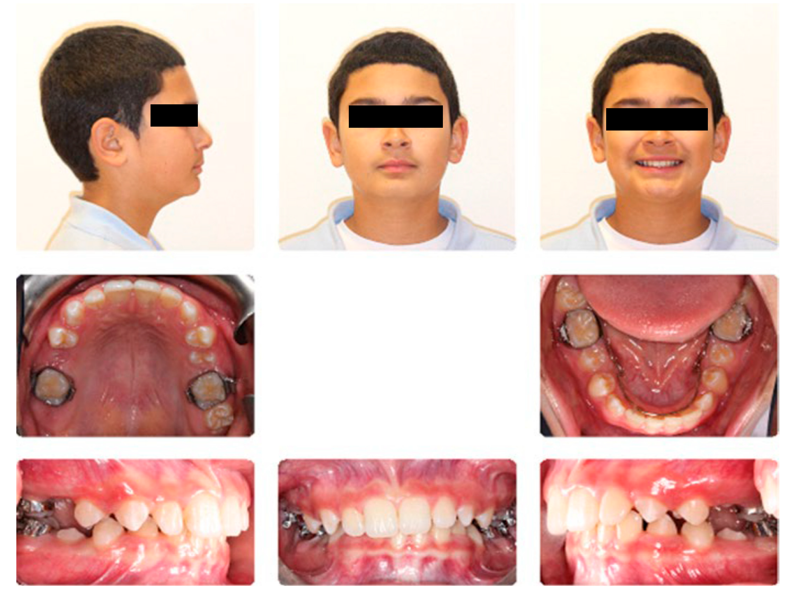 Dentistry 13 00300 g0a2a