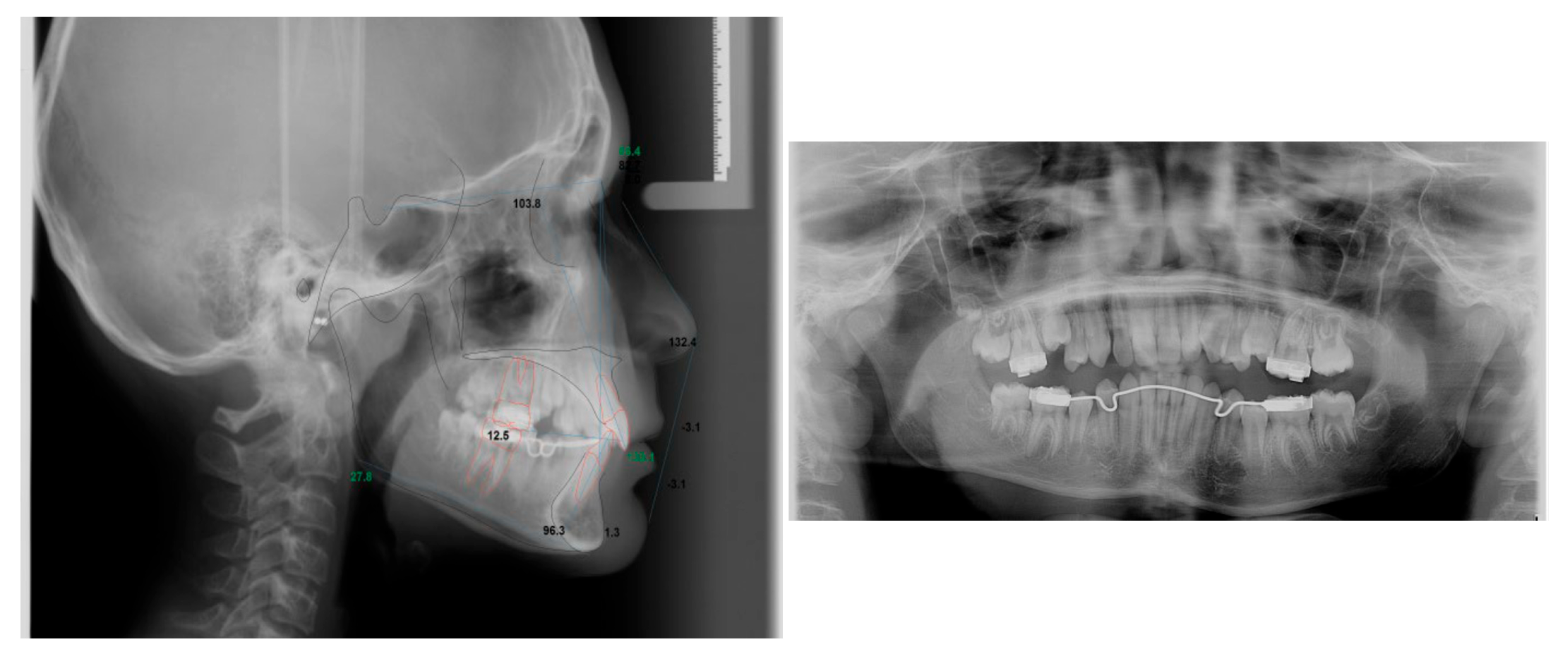Dentistry 13 00300 g0a2b