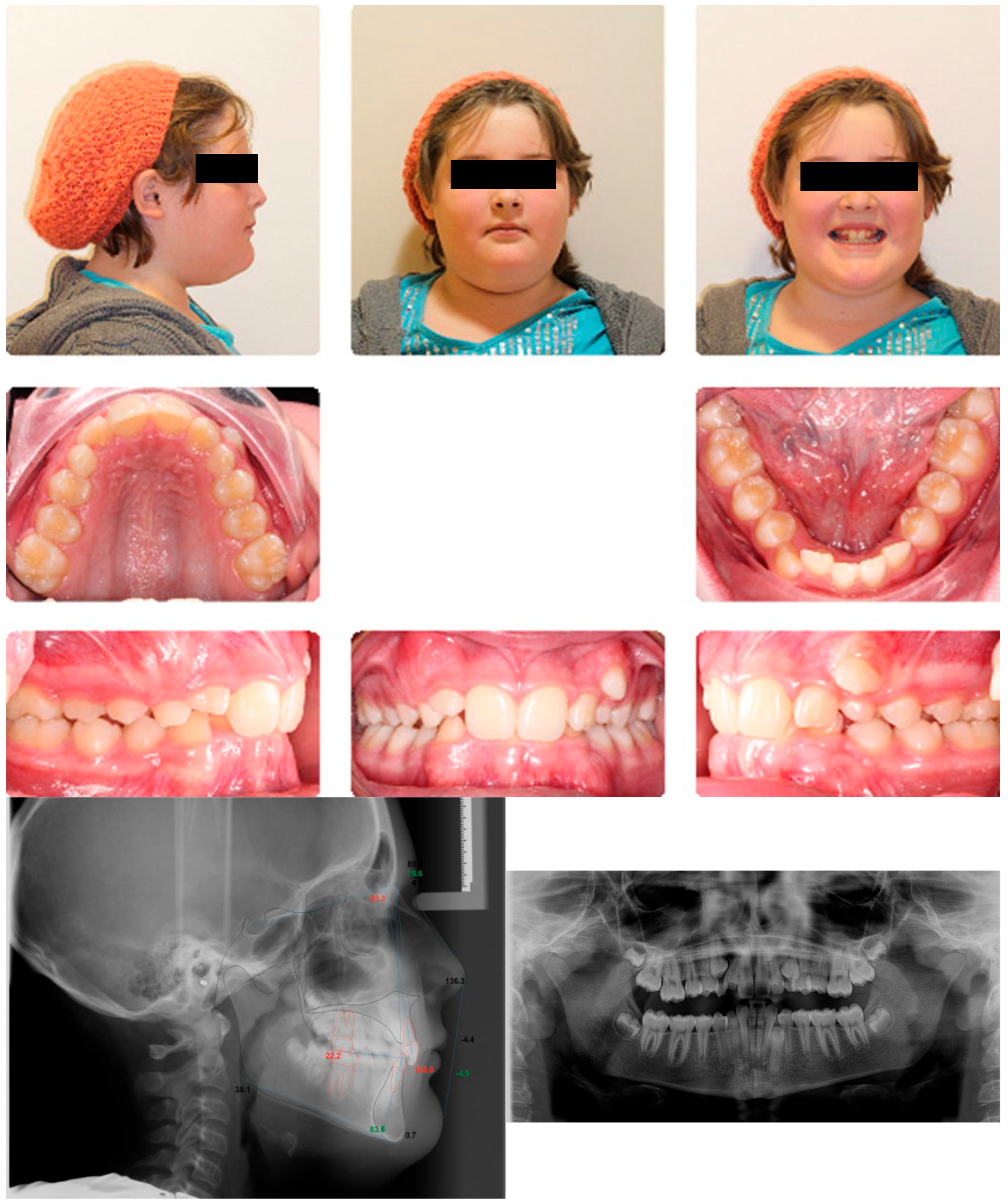 Dentistry 13 00300 g0a3