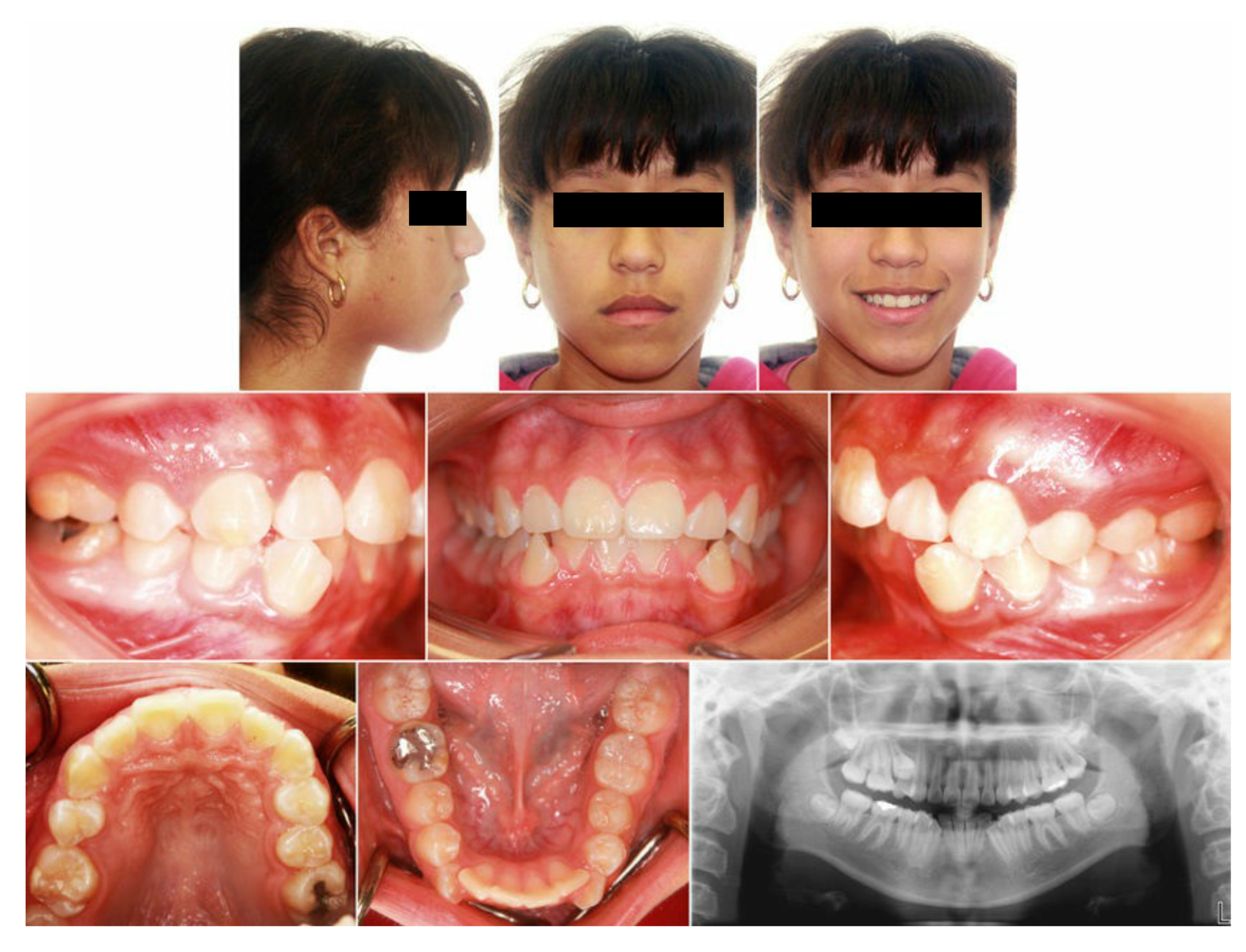 Dentistry 13 00300 g0a4