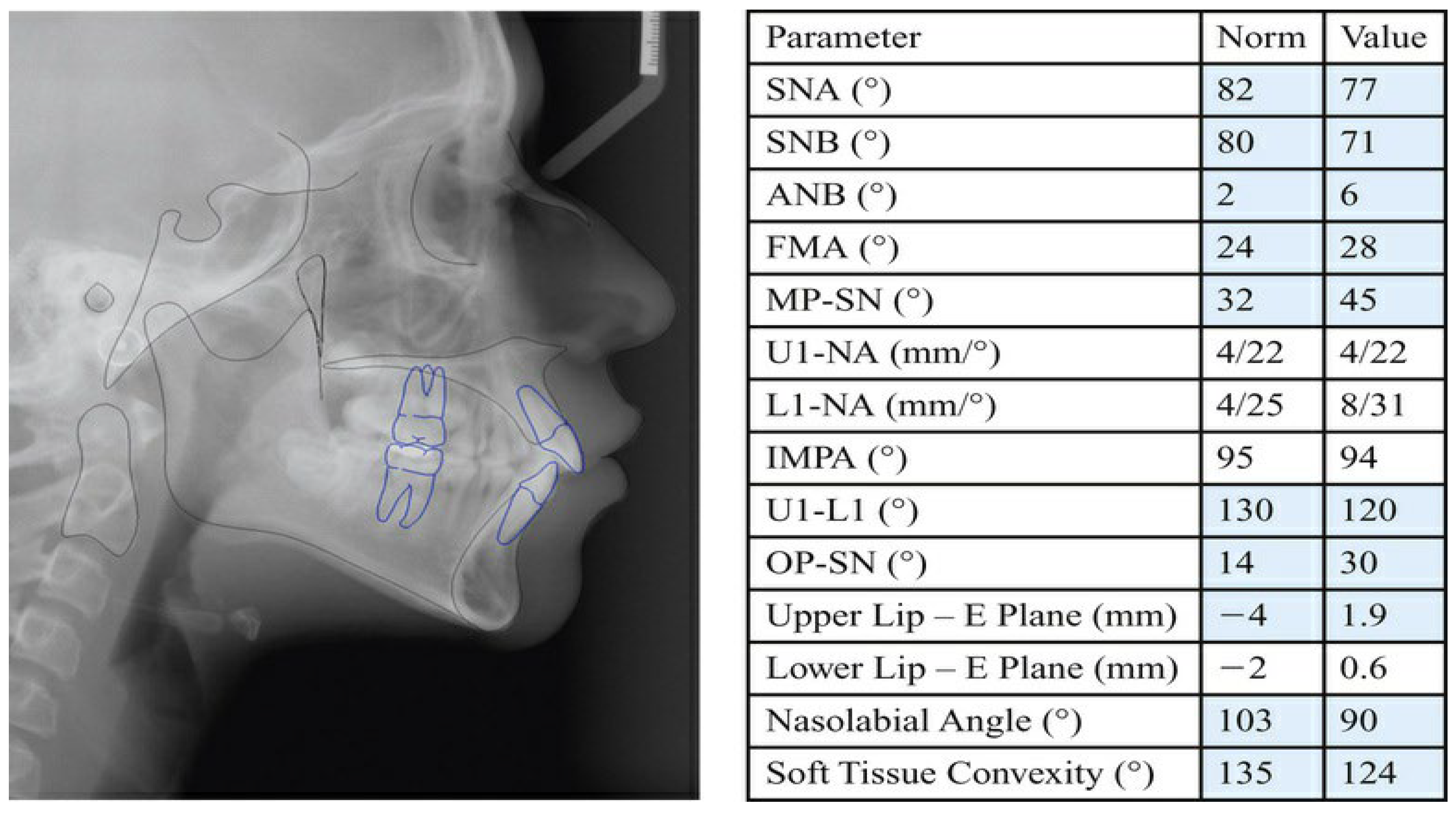 Dentistry 13 00300 g0a5