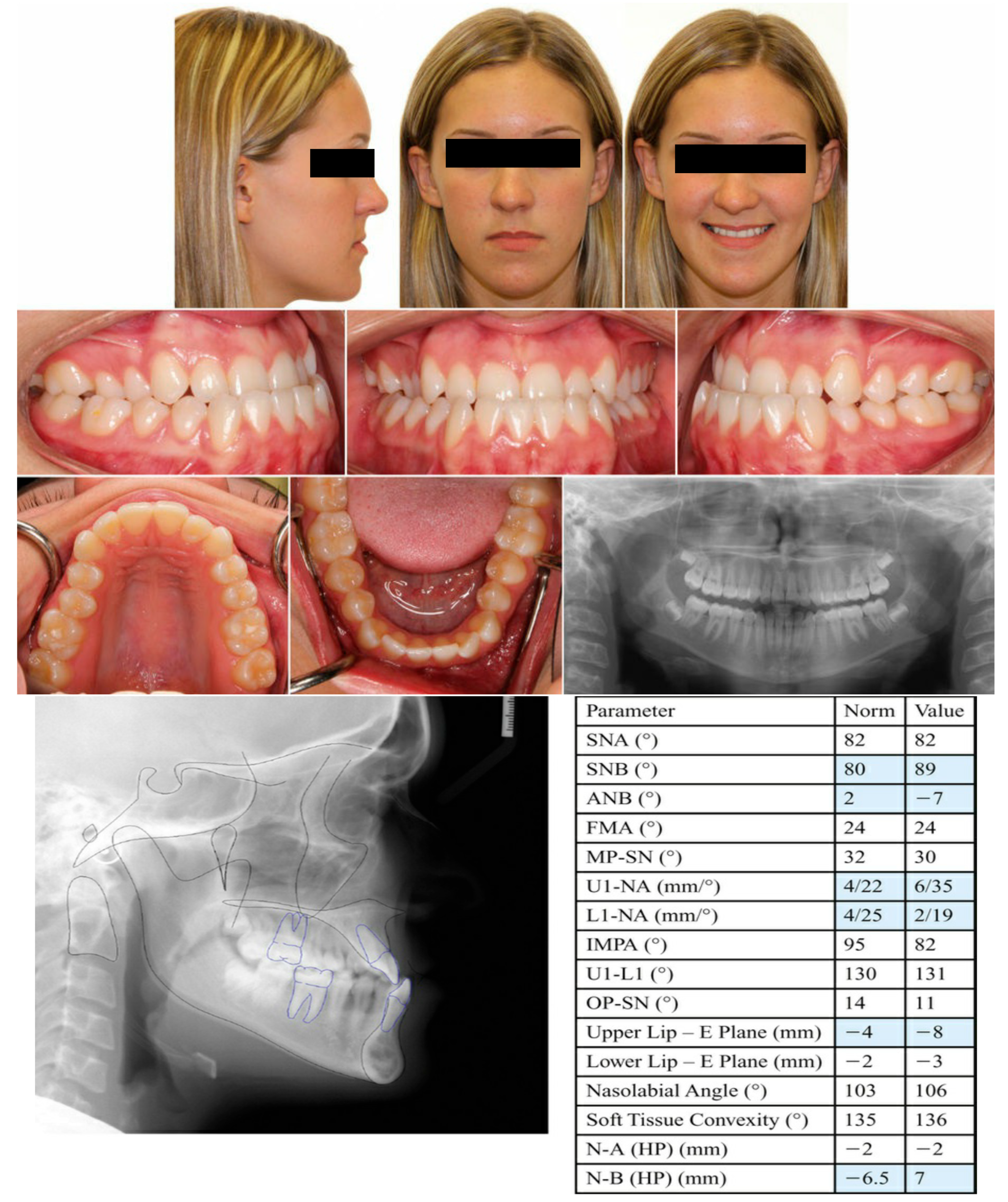 Dentistry 13 00300 g0a6