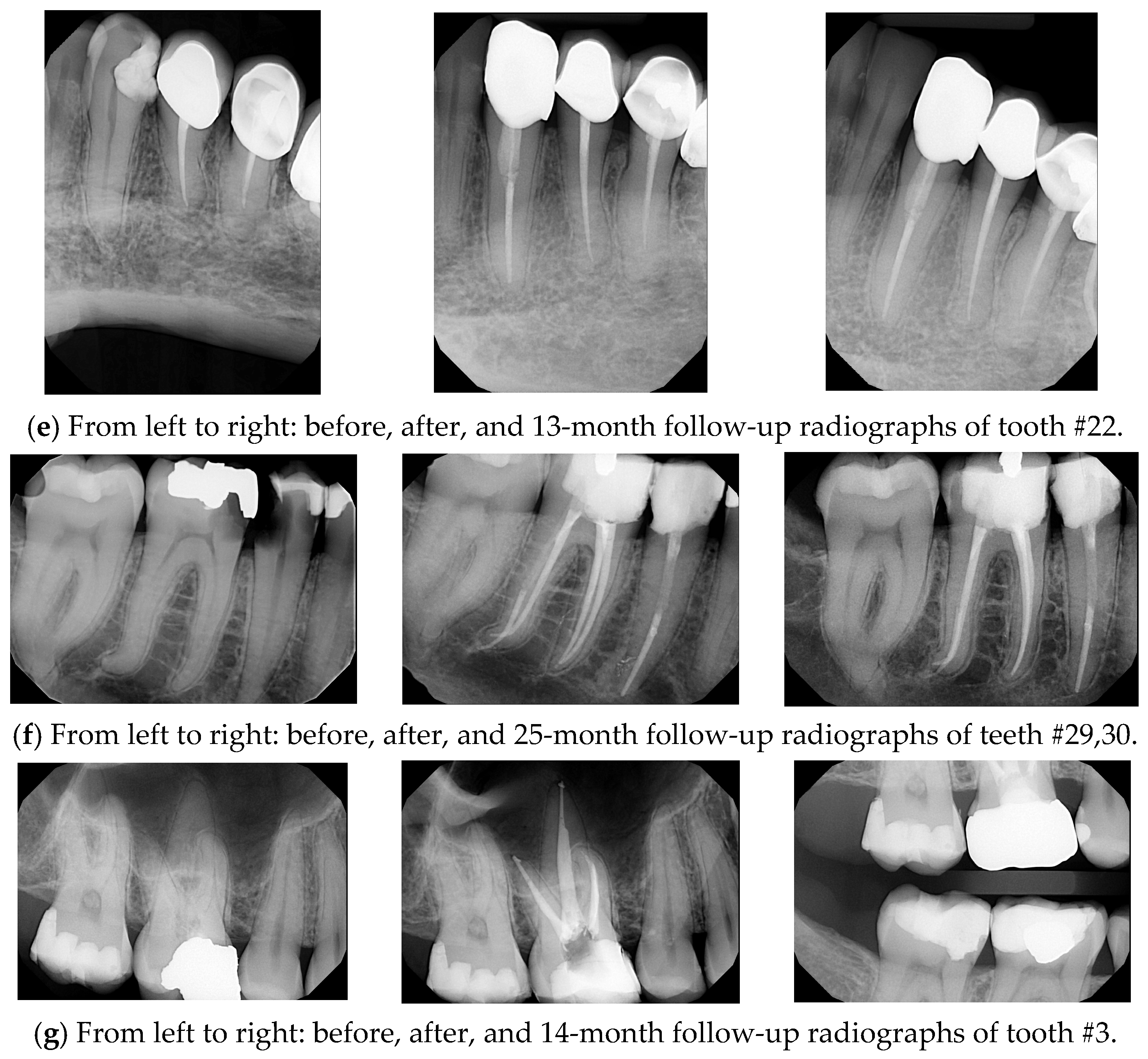 Dentistry 13 00306 g001b
