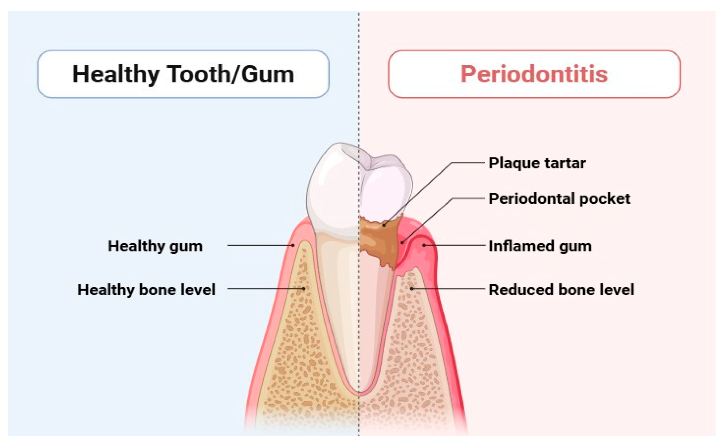 Dentistry 13 00314 g001