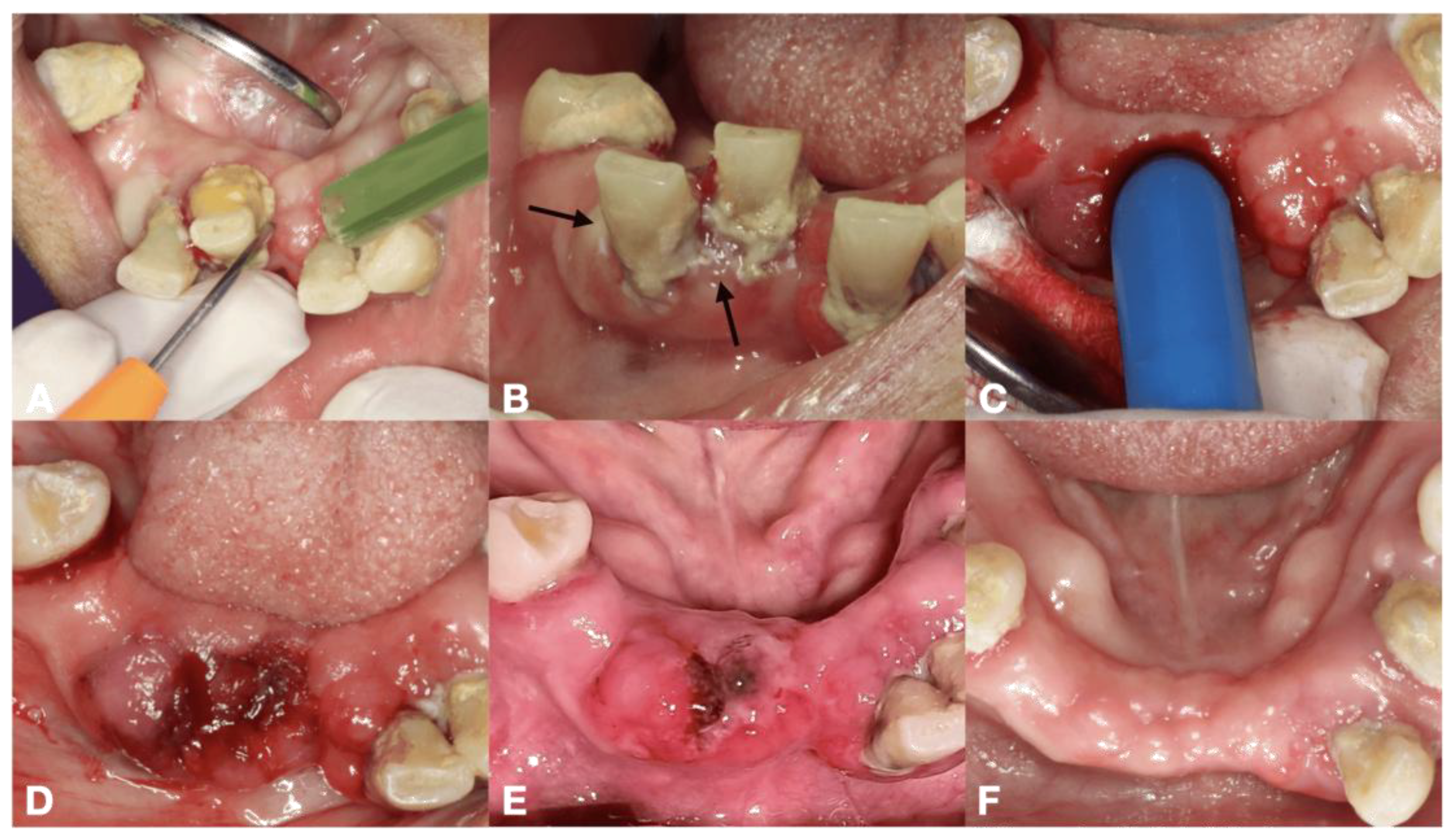 Dentistry 13 00315 g001