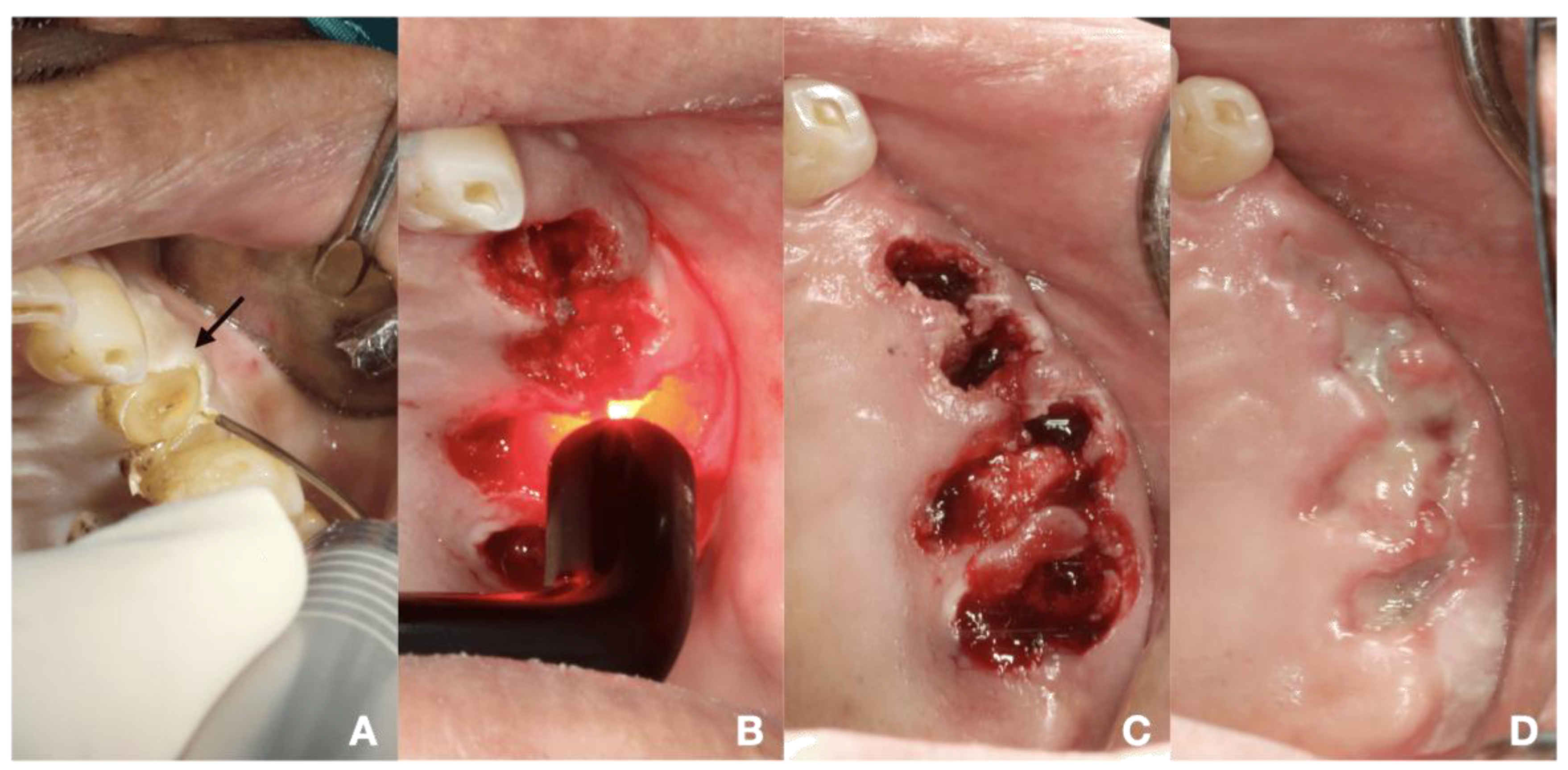 Dentistry 13 00315 g002