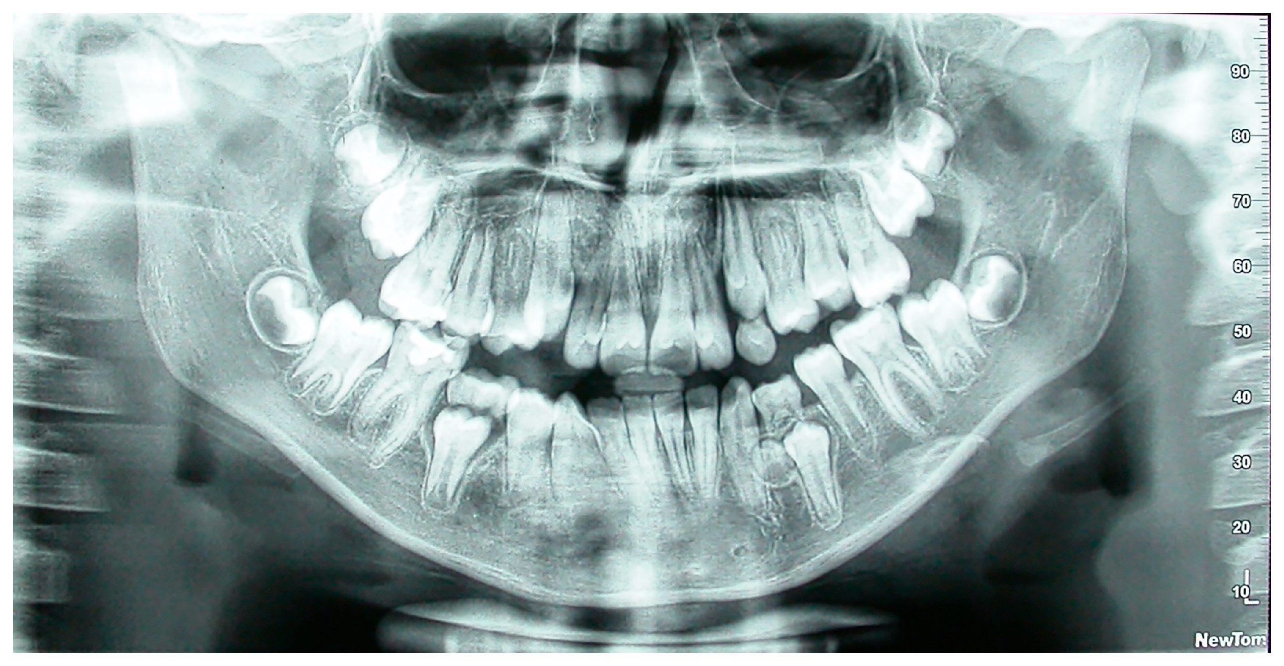 Dentistry 13 00317 g001