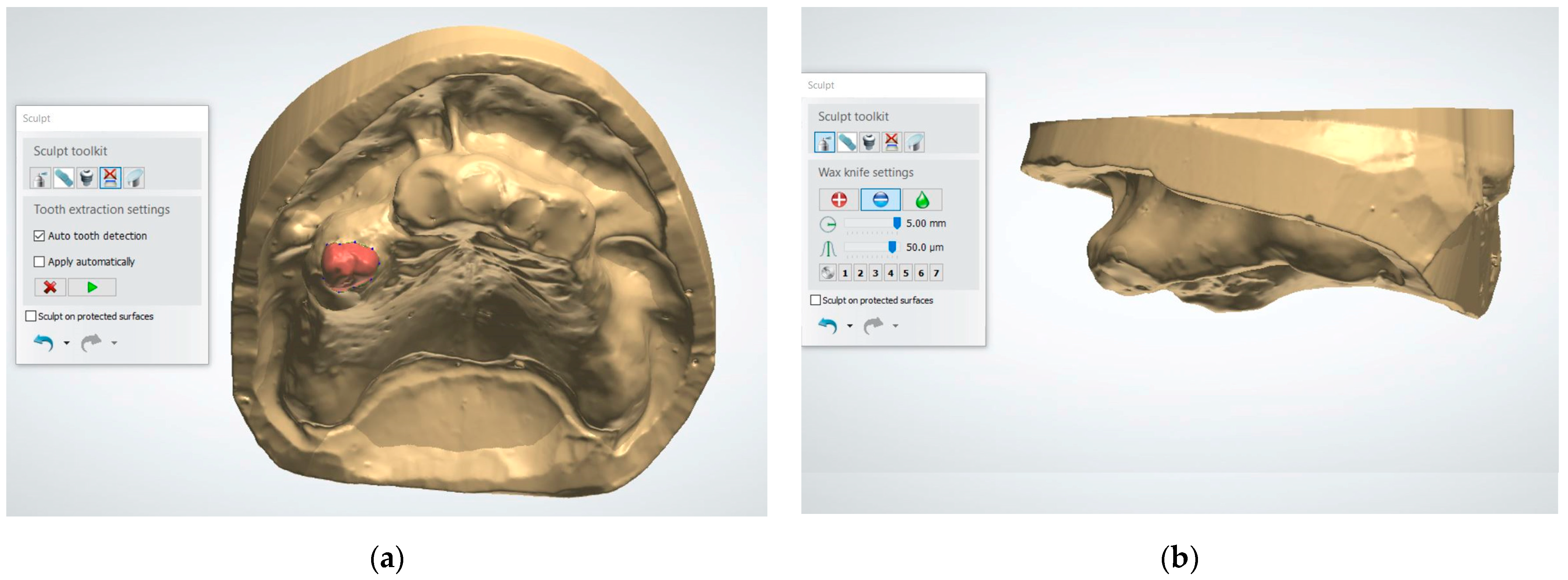 Dentistry 13 00333 g002