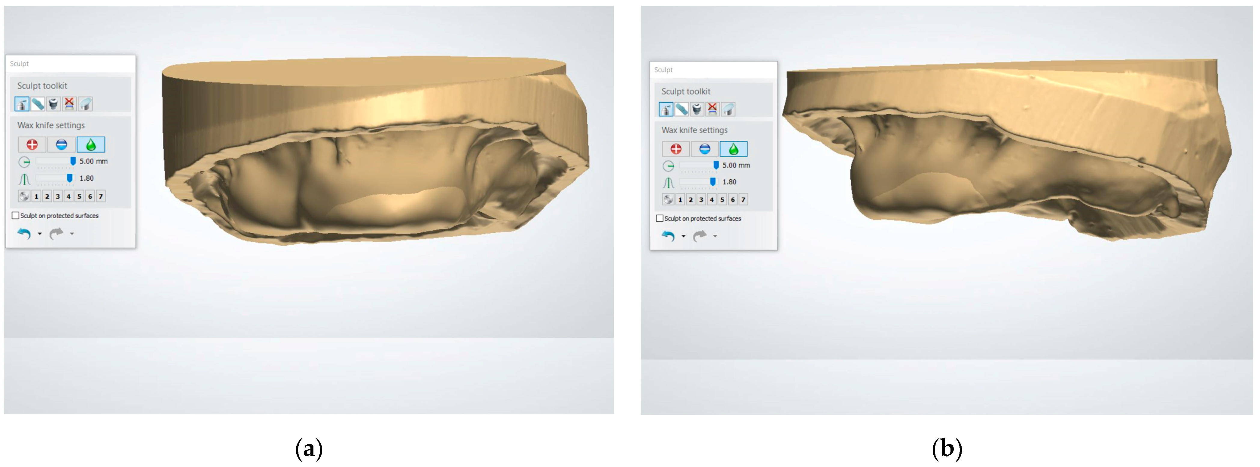 Dentistry 13 00333 g003