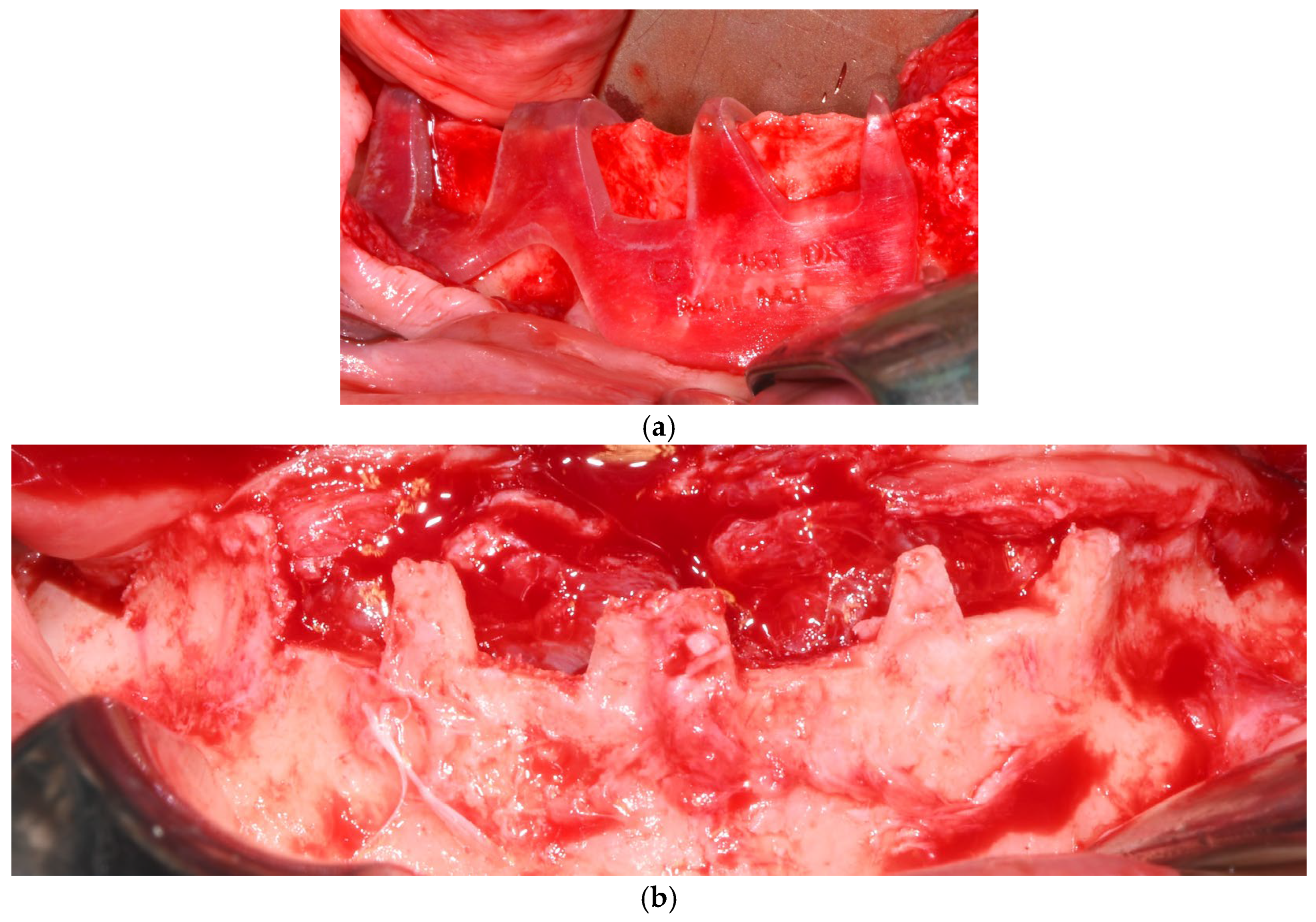 Dentistry 13 00337 g003