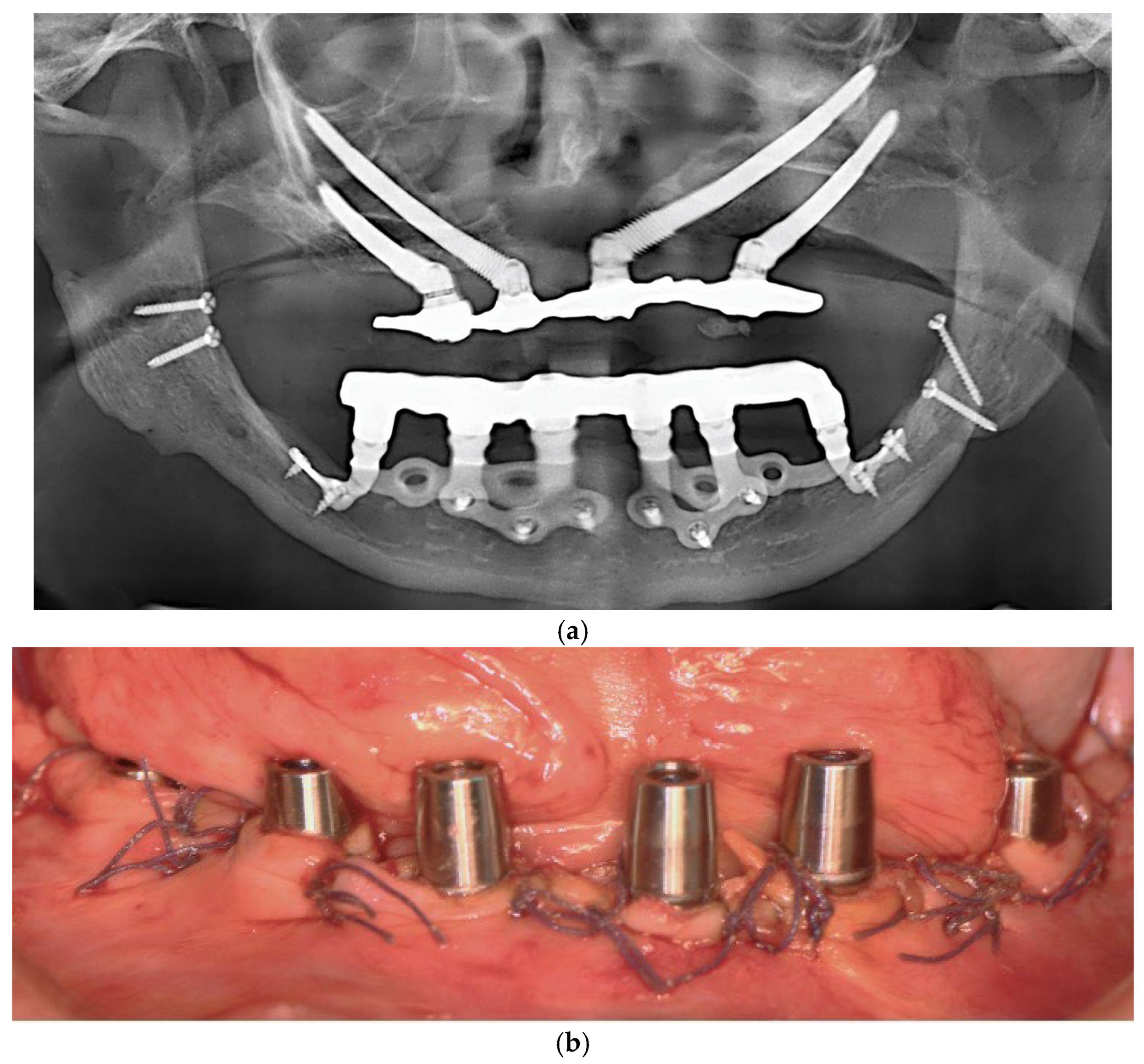 Dentistry 13 00337 g005