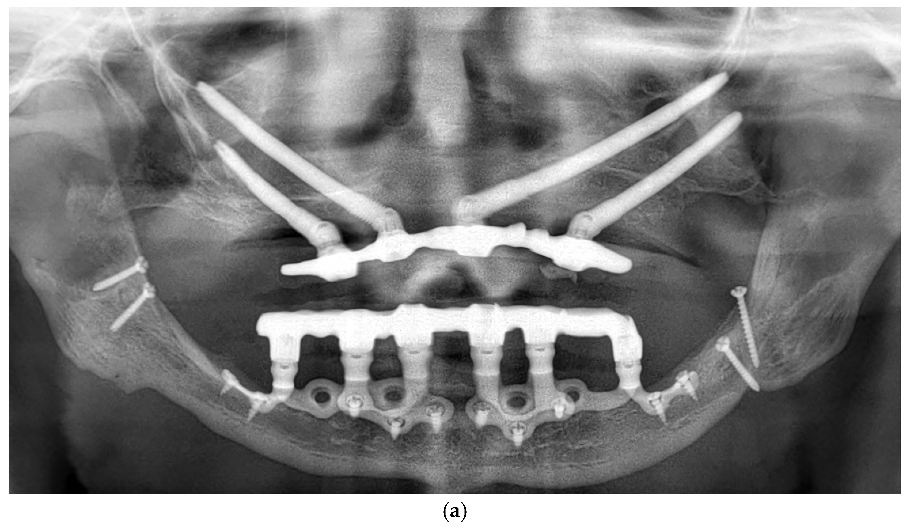 Dentistry 13 00337 g006a