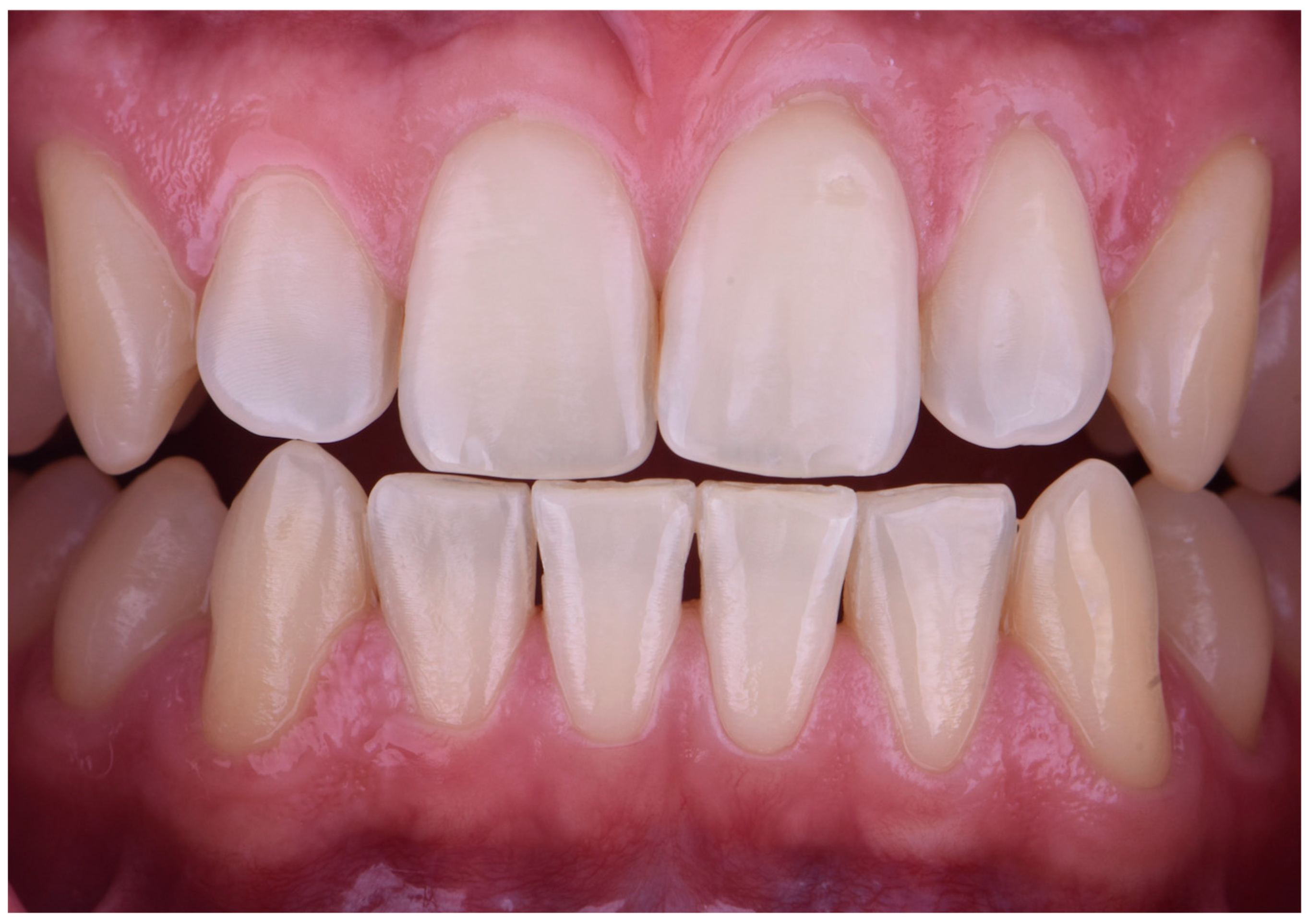 Dentistry 13 00339 g003