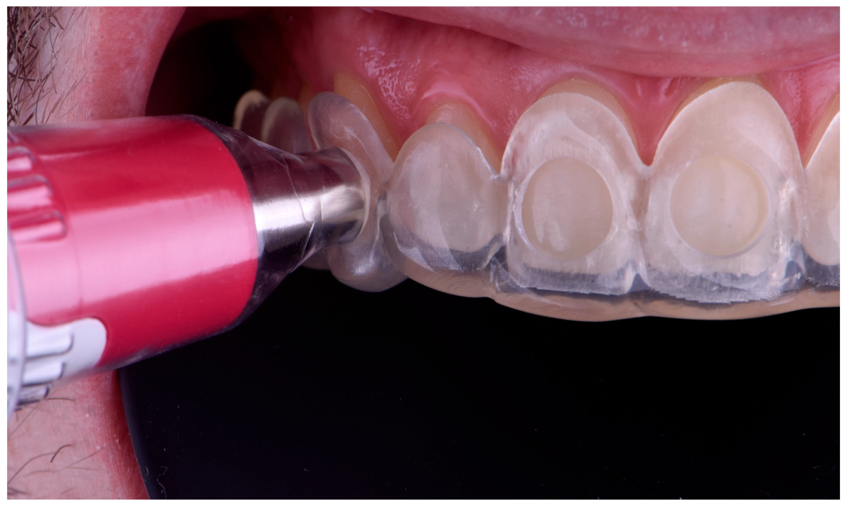 Dentistry 13 00339 g004