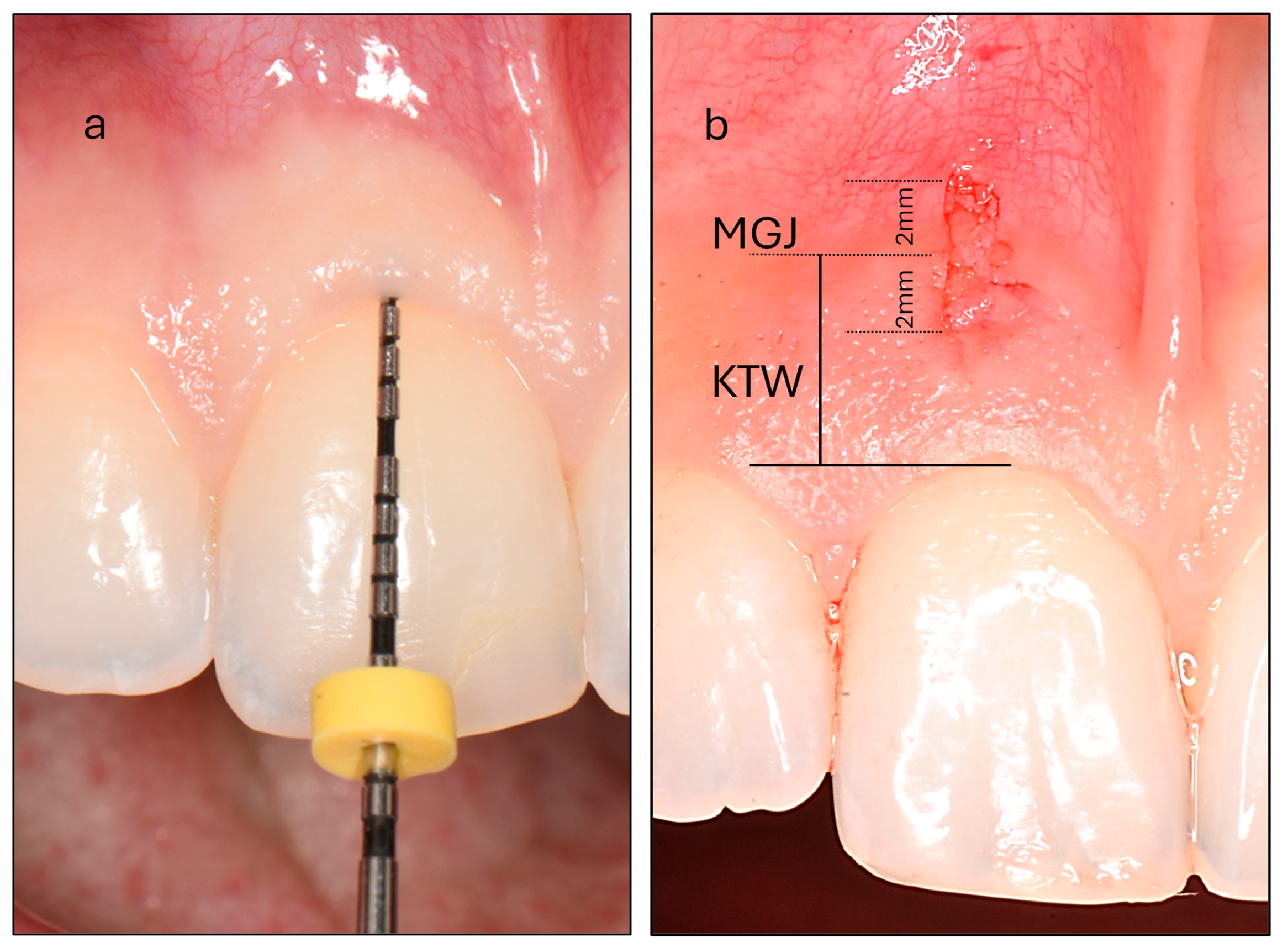 Dentistry 13 00350 g001