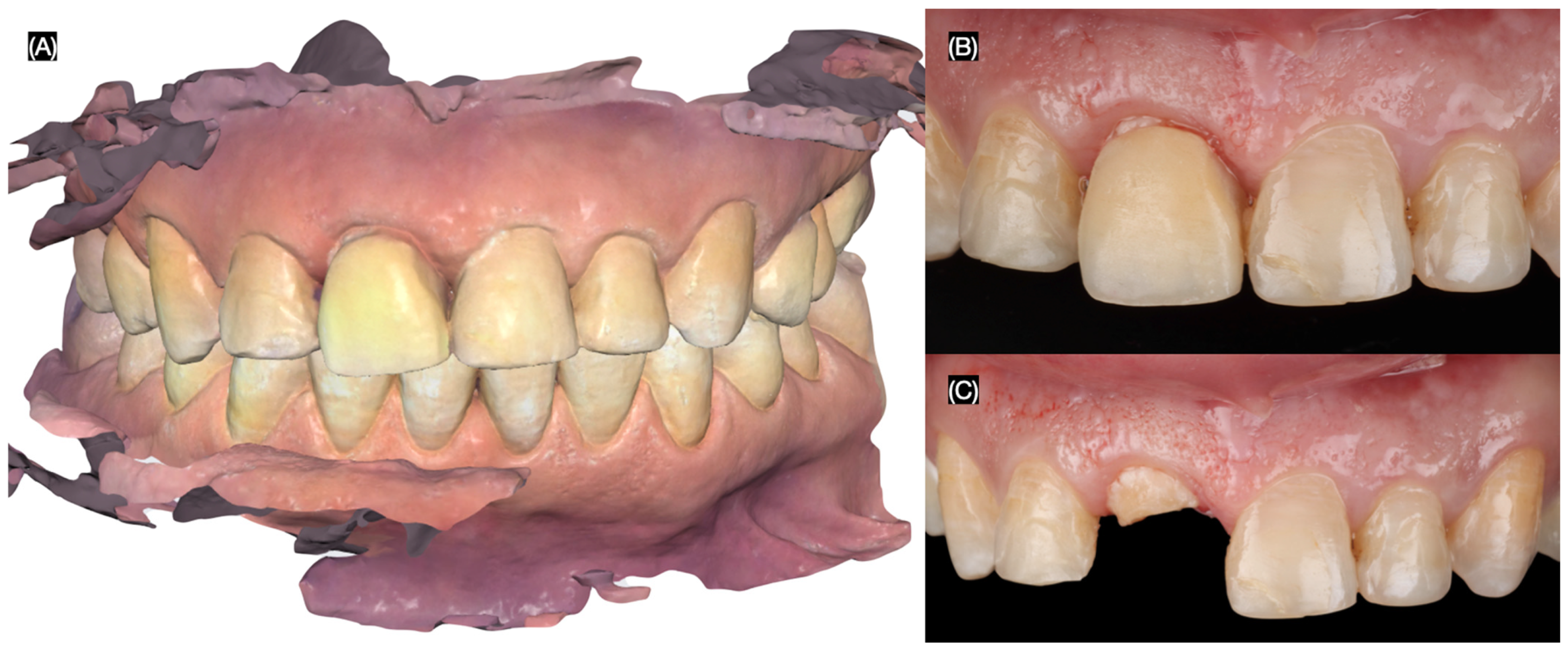 Dentistry 13 00365 g001