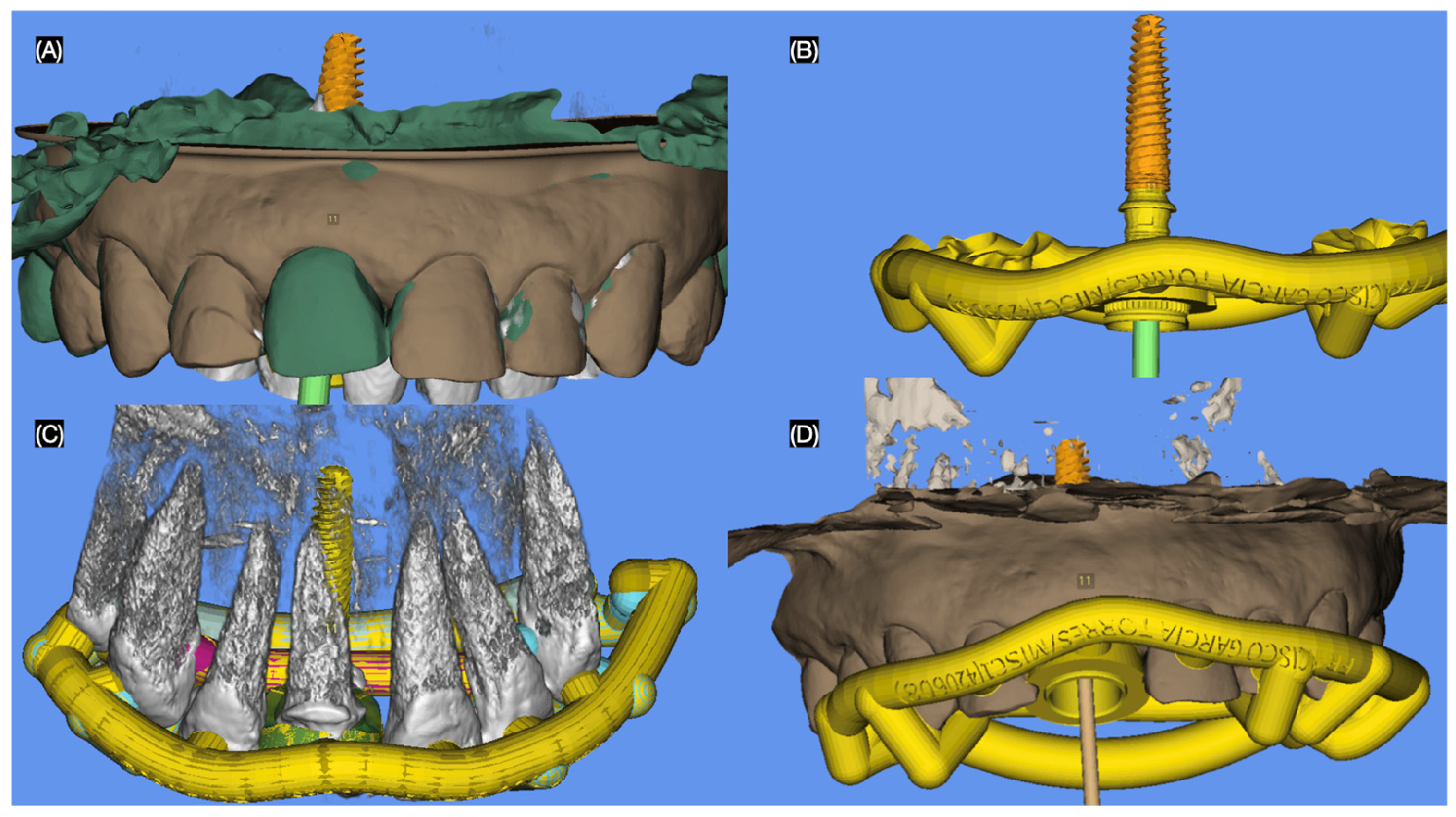 Dentistry 13 00365 g003