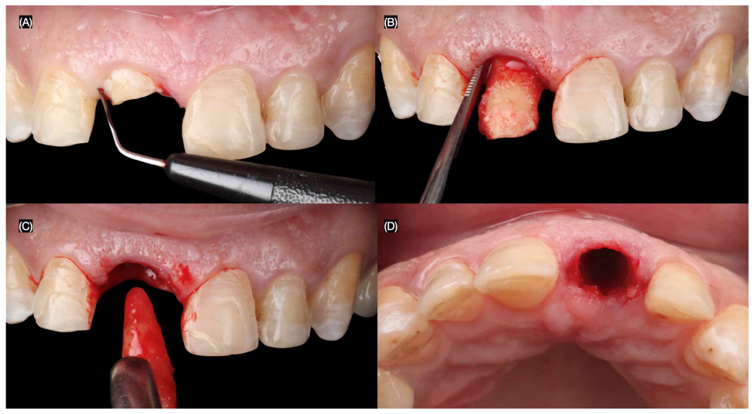 Dentistry 13 00365 g004