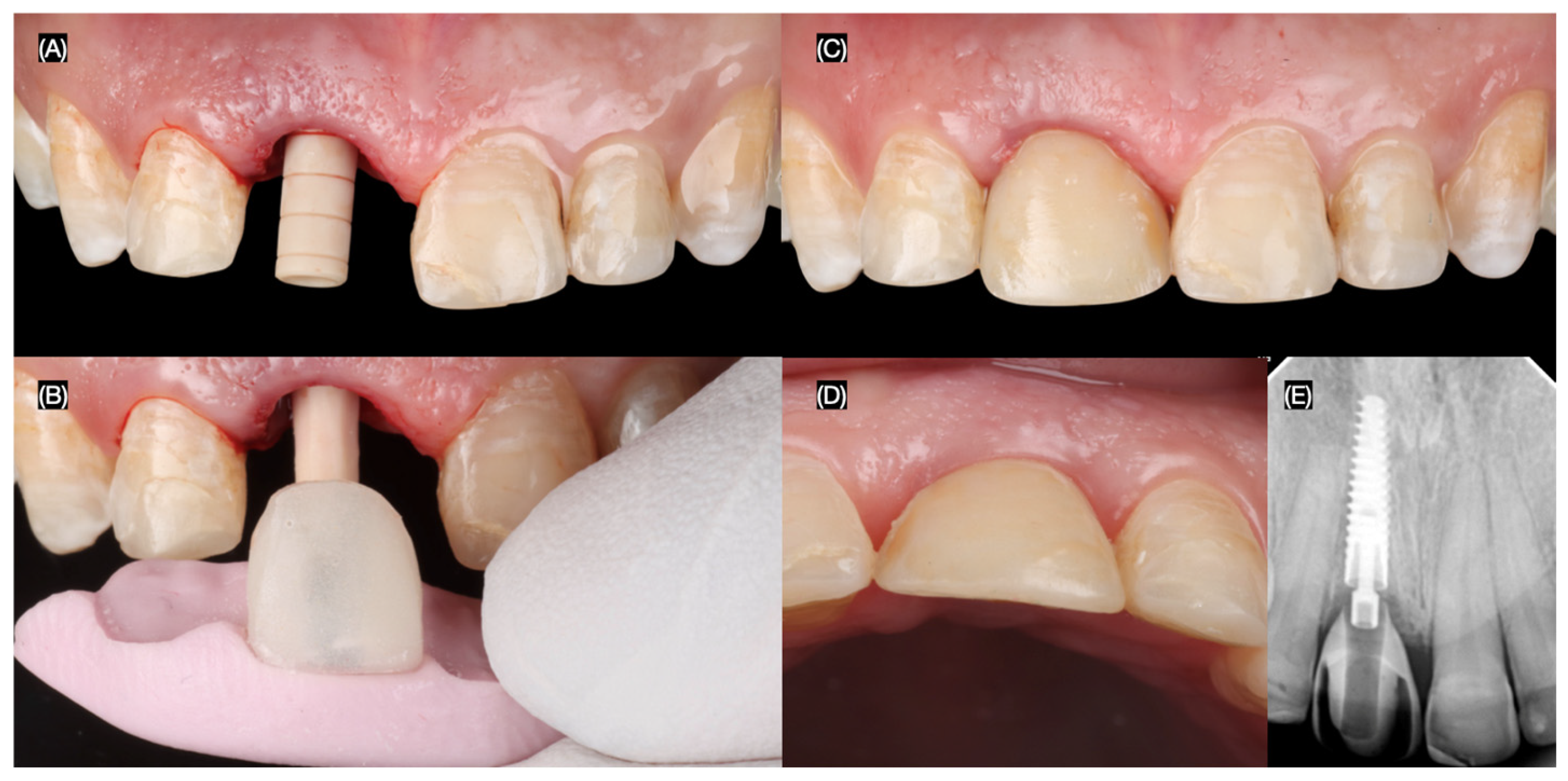 Dentistry 13 00365 g006