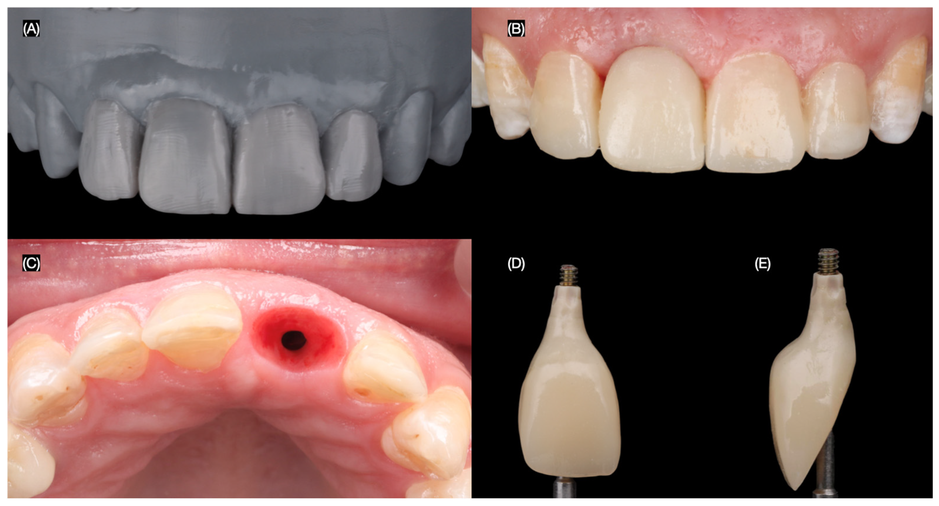 Dentistry 13 00365 g007