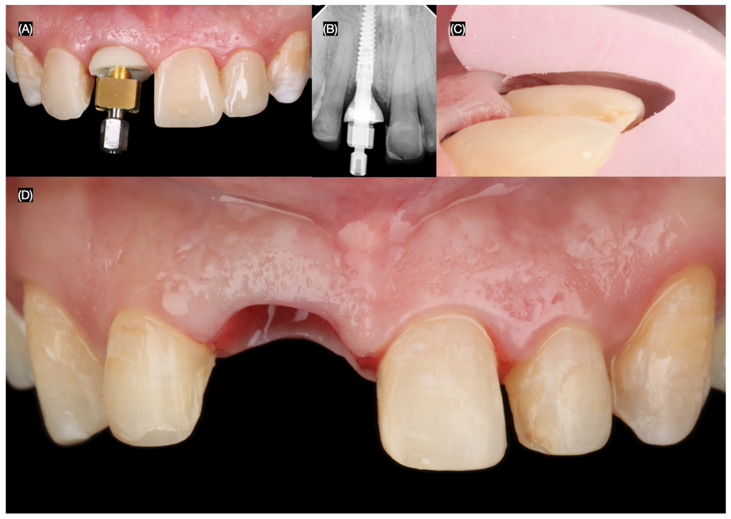 Dentistry 13 00365 g008