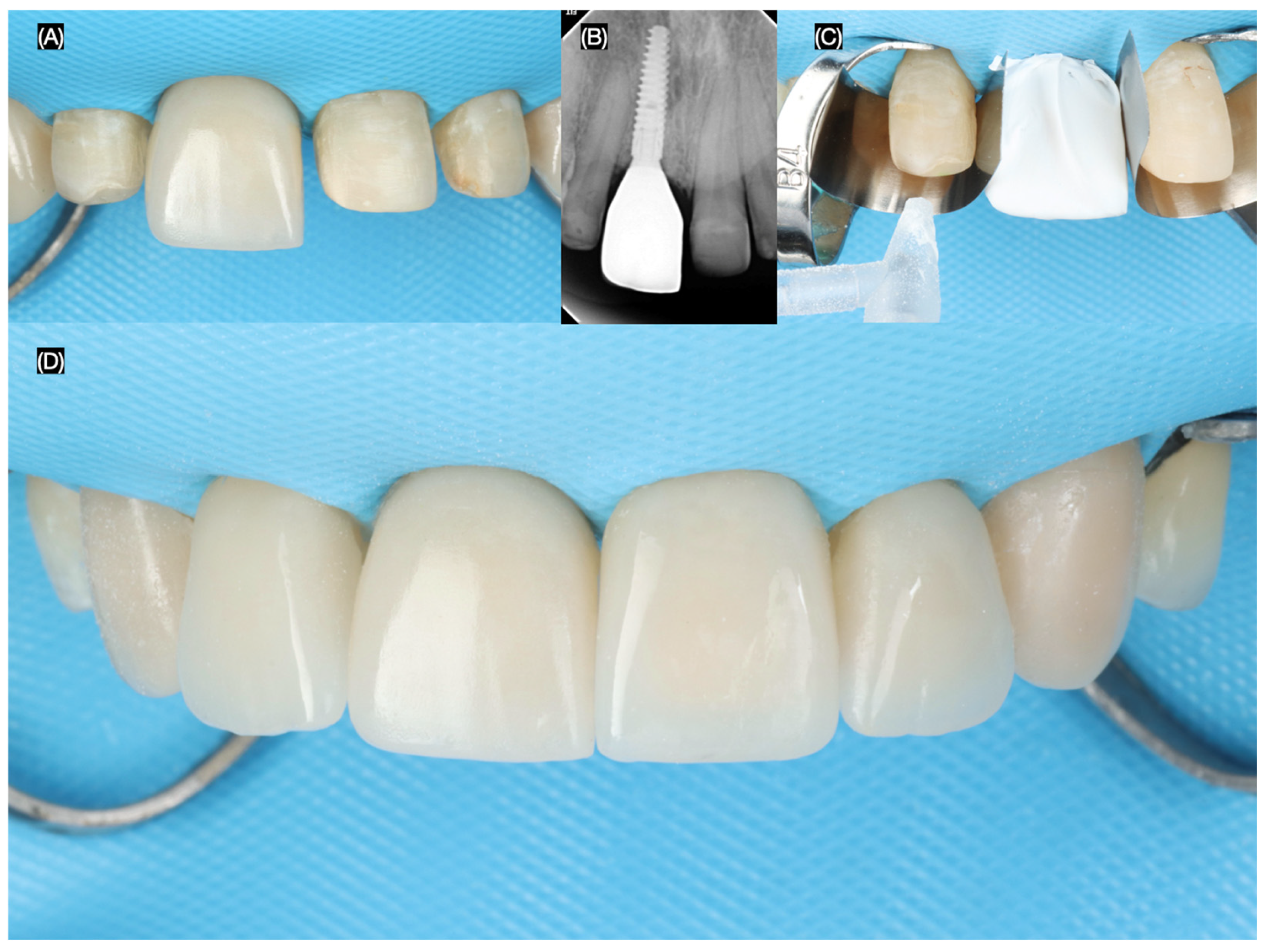 Dentistry 13 00365 g009