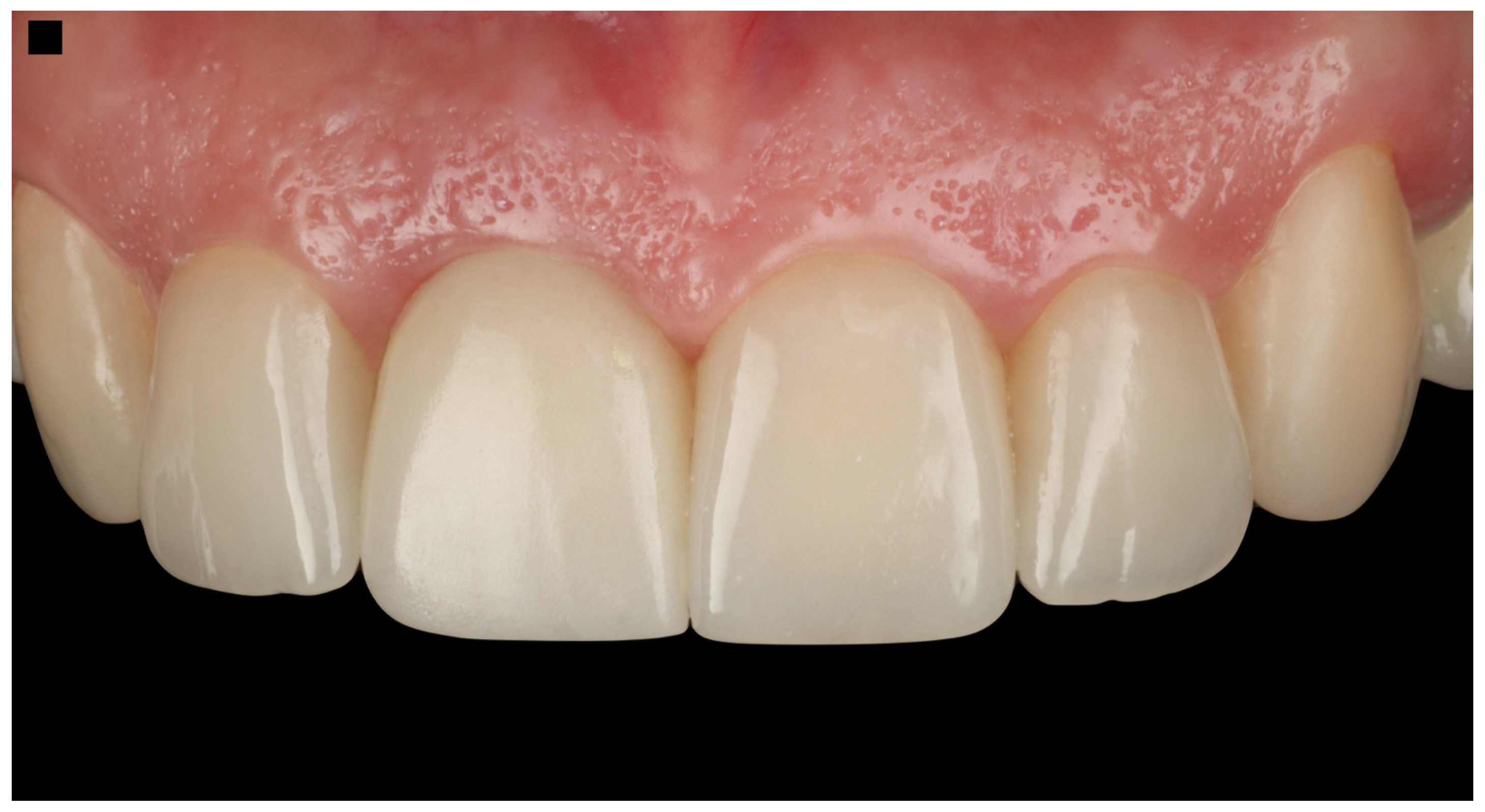 Dentistry 13 00365 g010