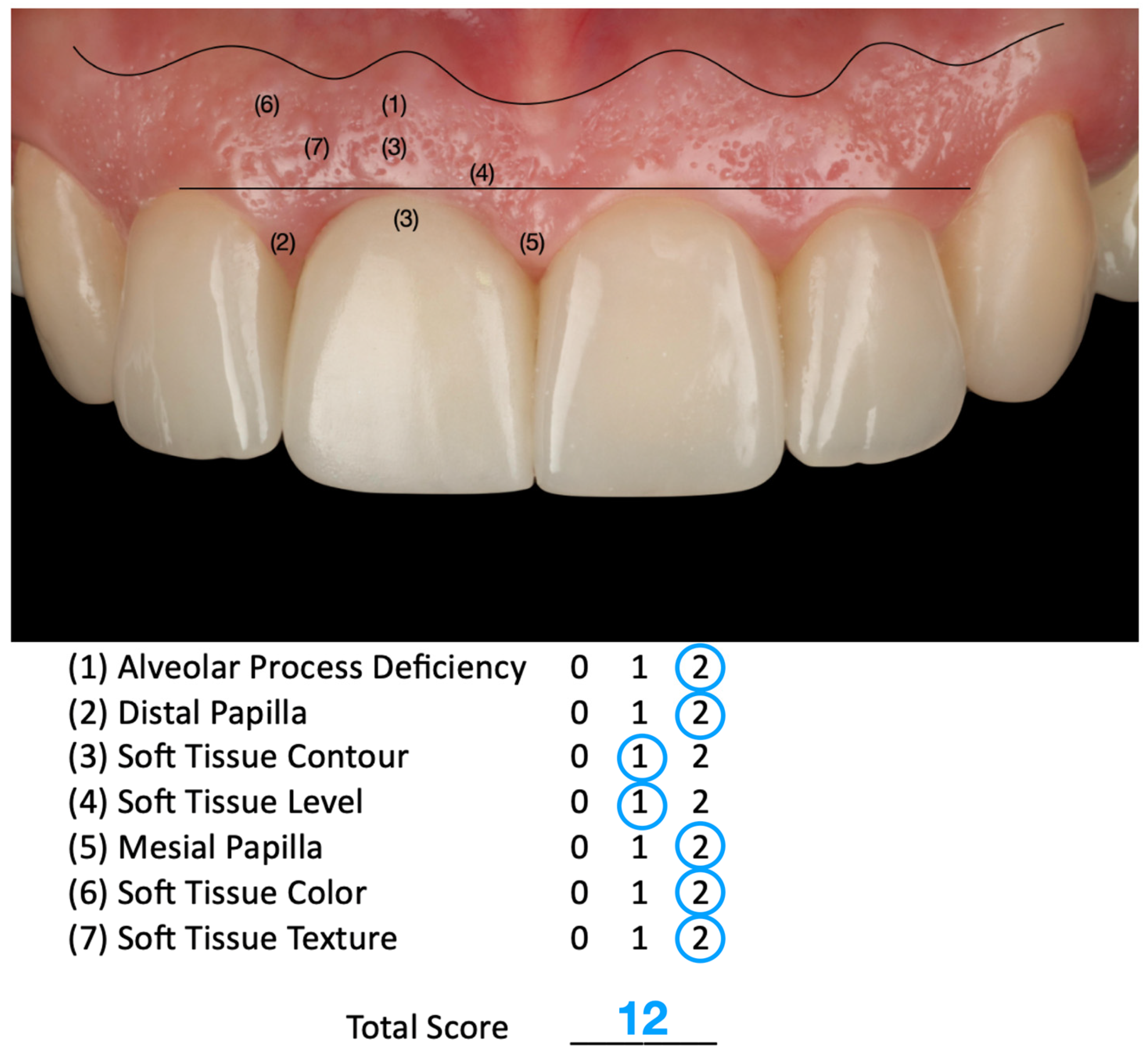 Dentistry 13 00365 g011