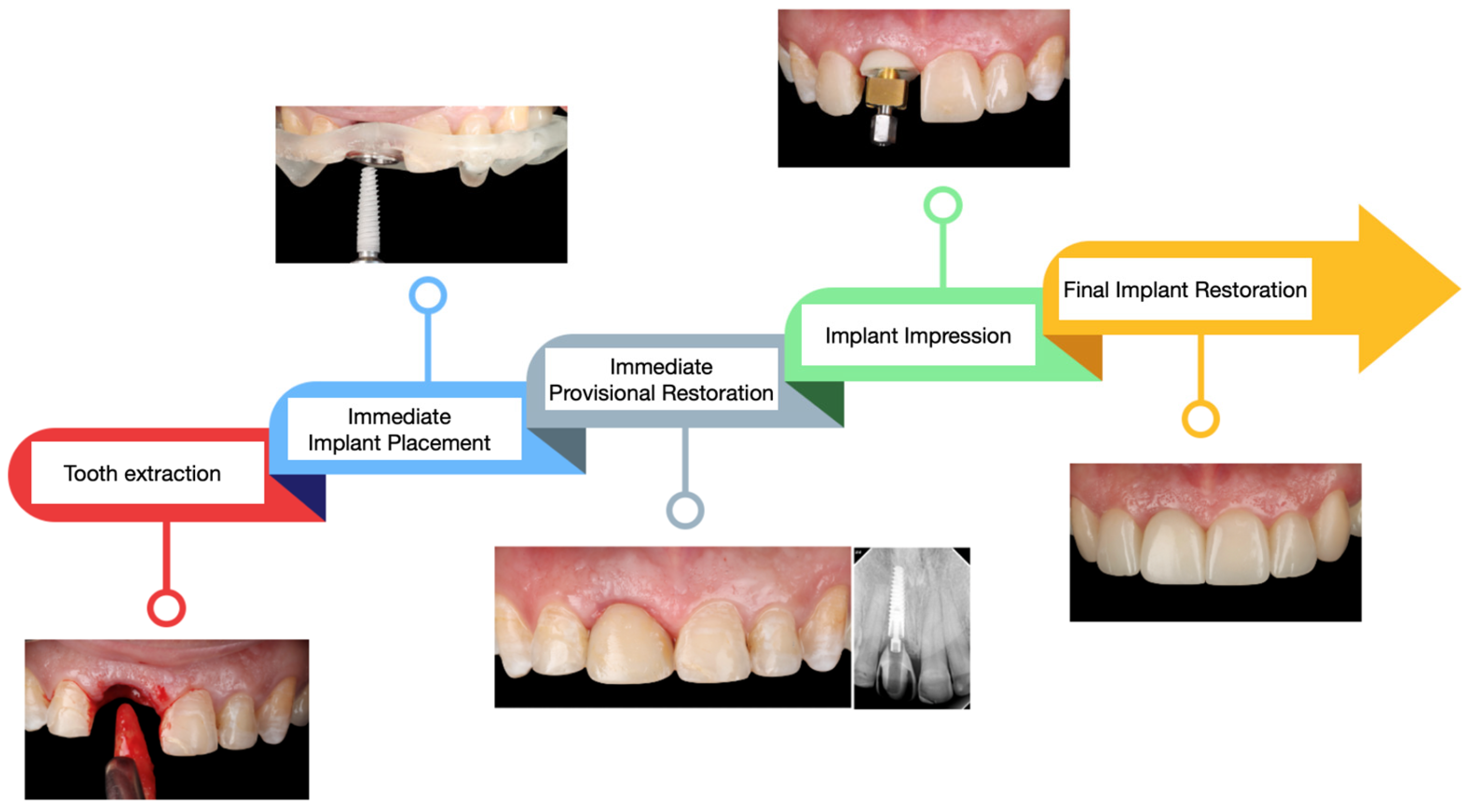 Dentistry 13 00365 g012
