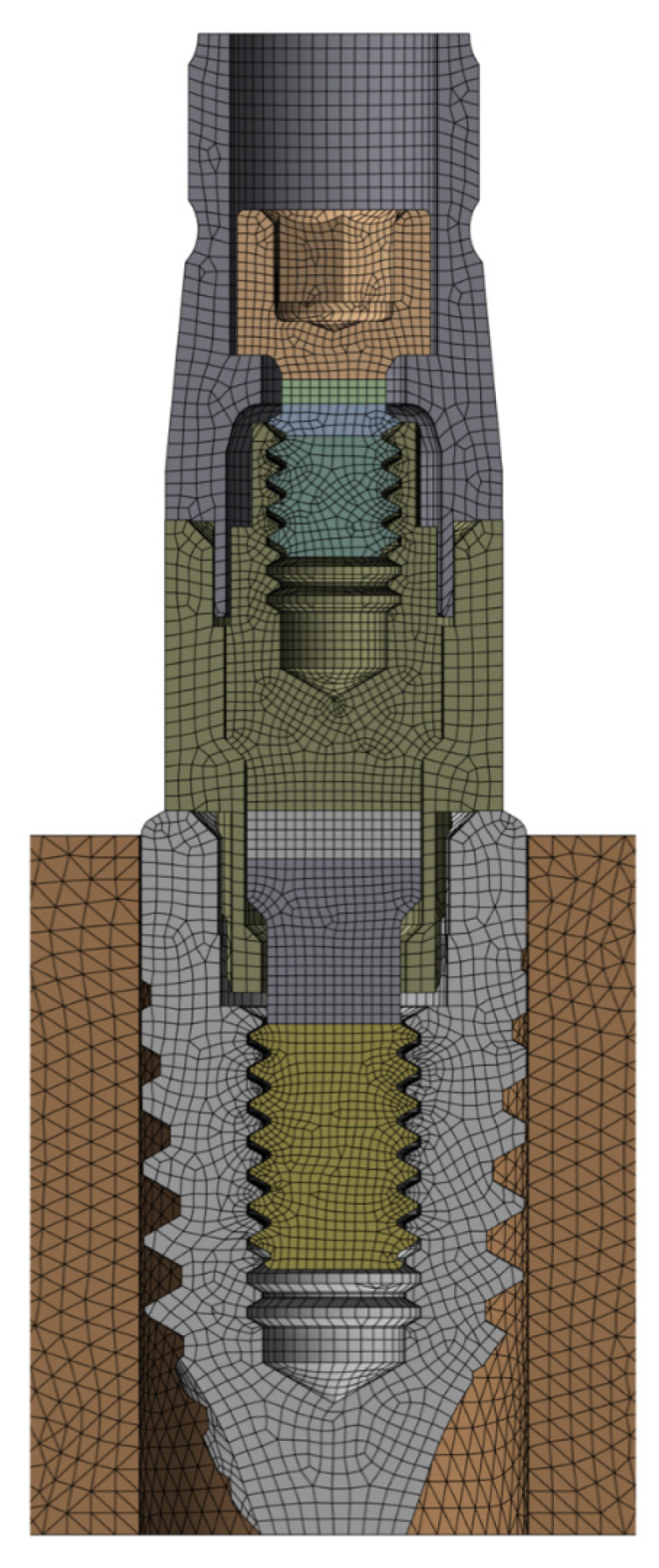 Dentistry 13 00374 g002 Dentistry 13 00374 g002