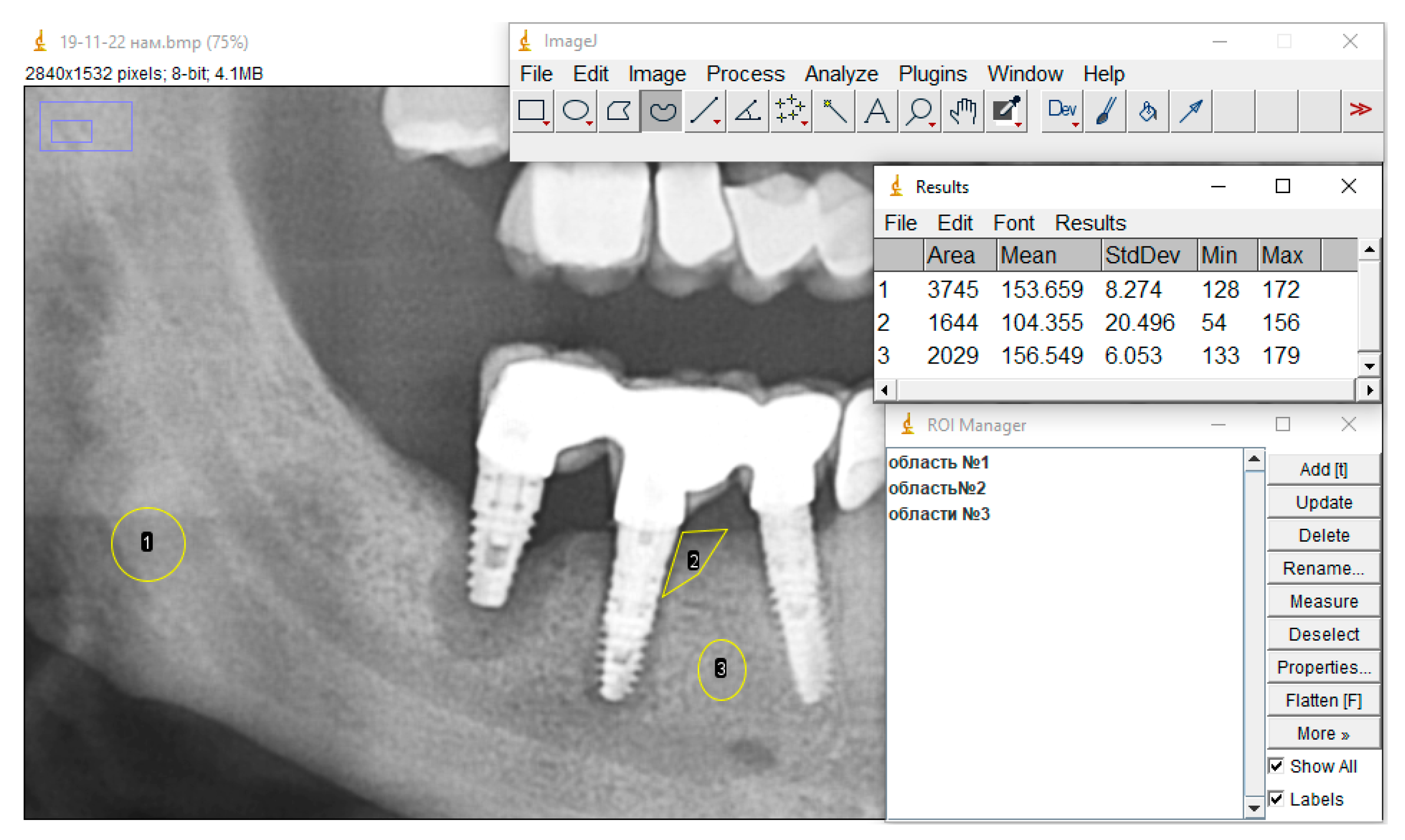 Dentistry 13 00375 g004 Dentistry 13 00375 g004