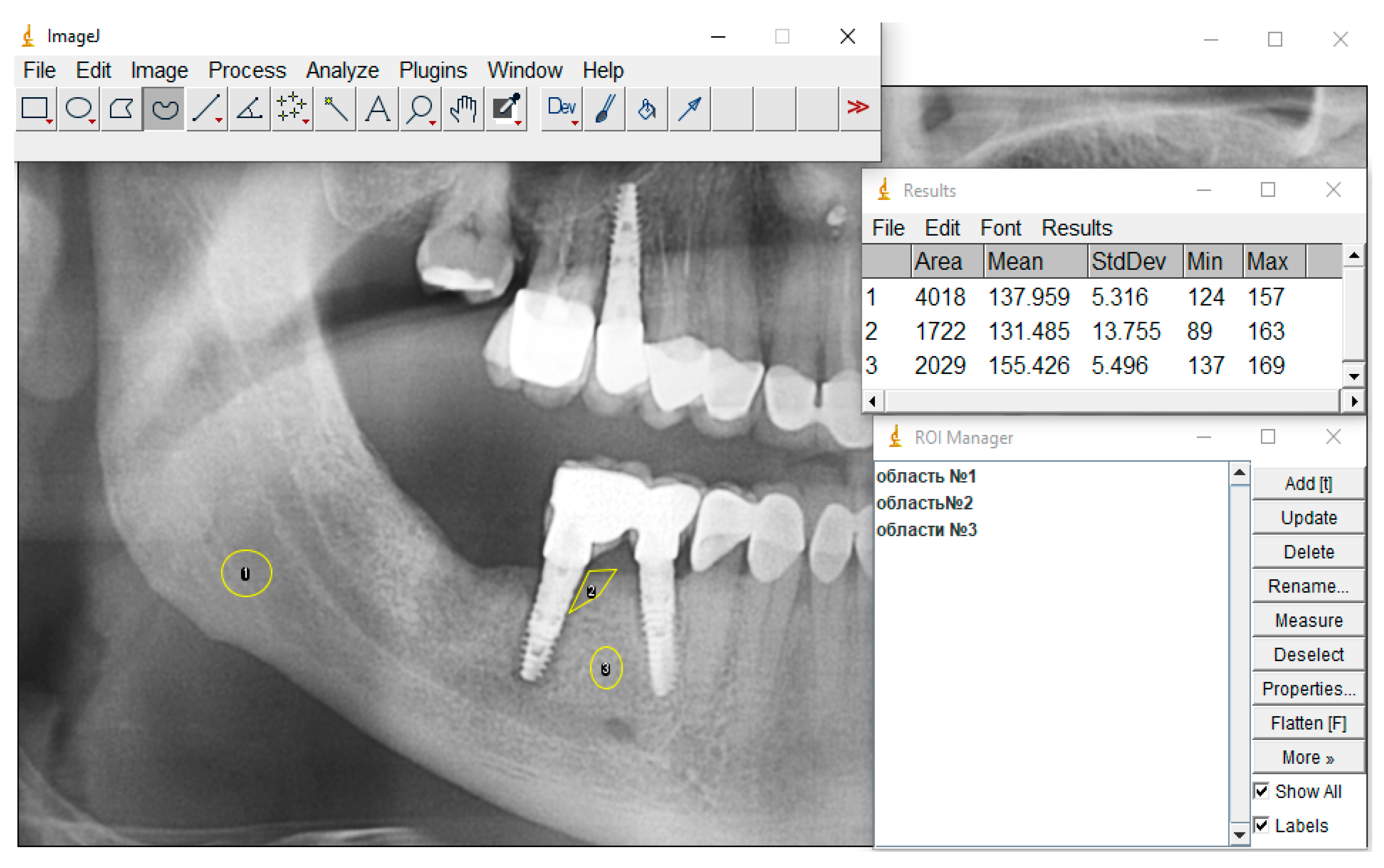 Dentistry 13 00375 g005 Dentistry 13 00375 g005