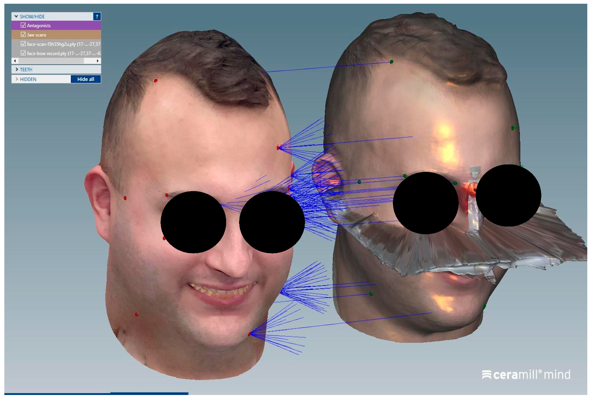 Dentistry 13 00378 g006