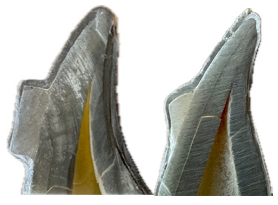 Dentistry 13 00379 g003