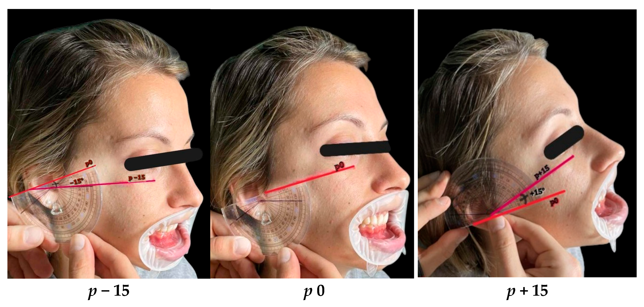 Dentistry 13 00380 g002