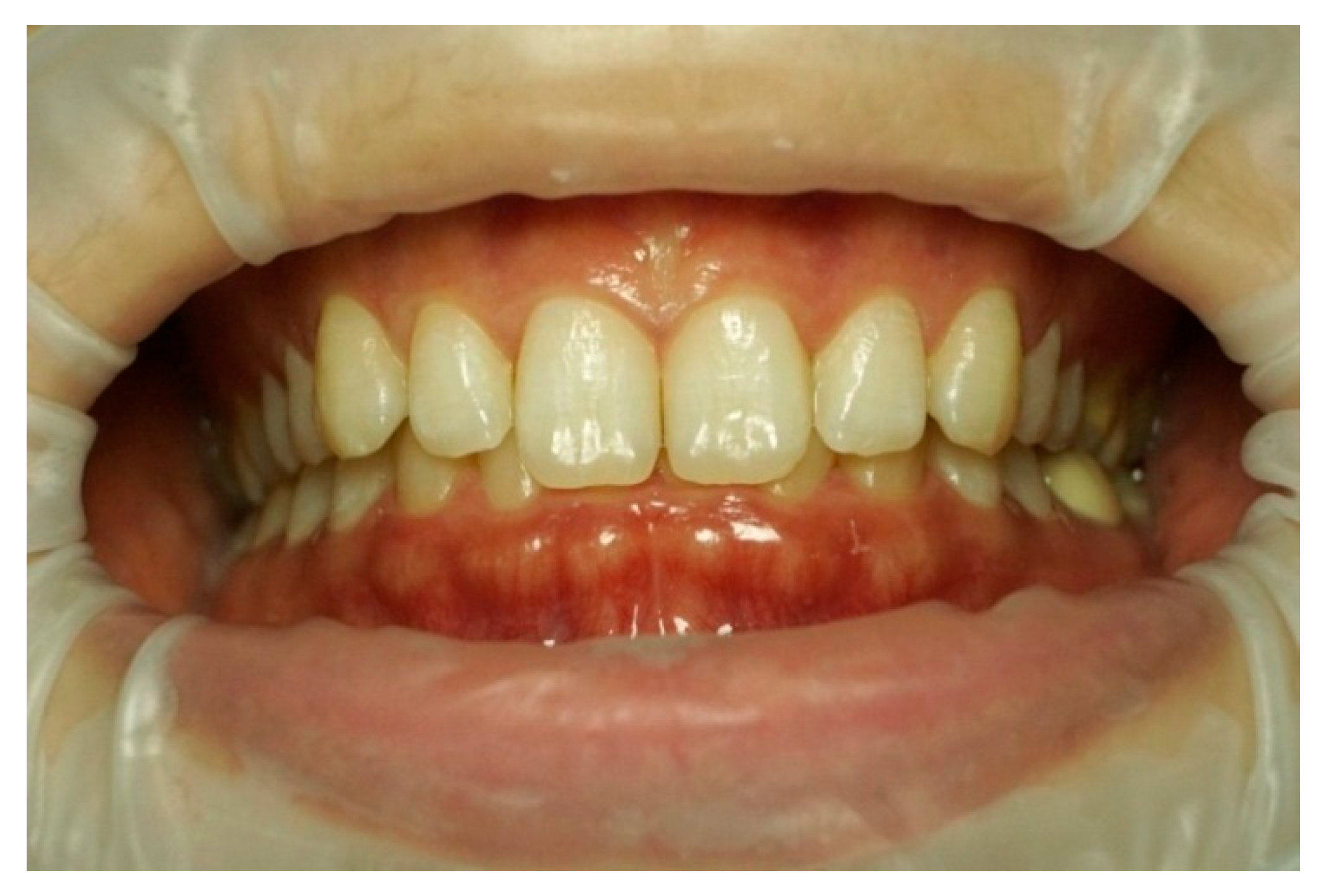 Dentistry 13 00380 g005