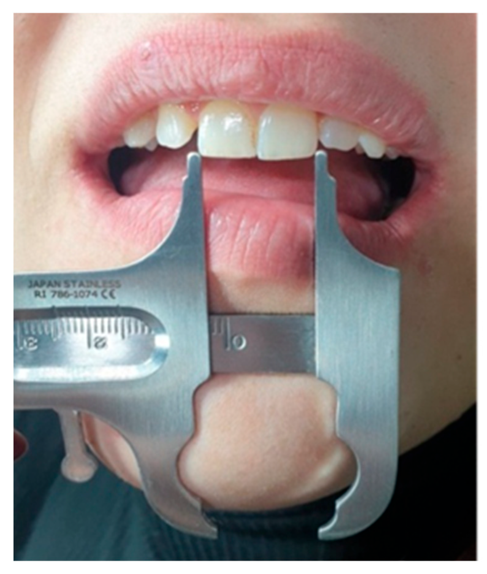 Dentistry 13 00380 g006